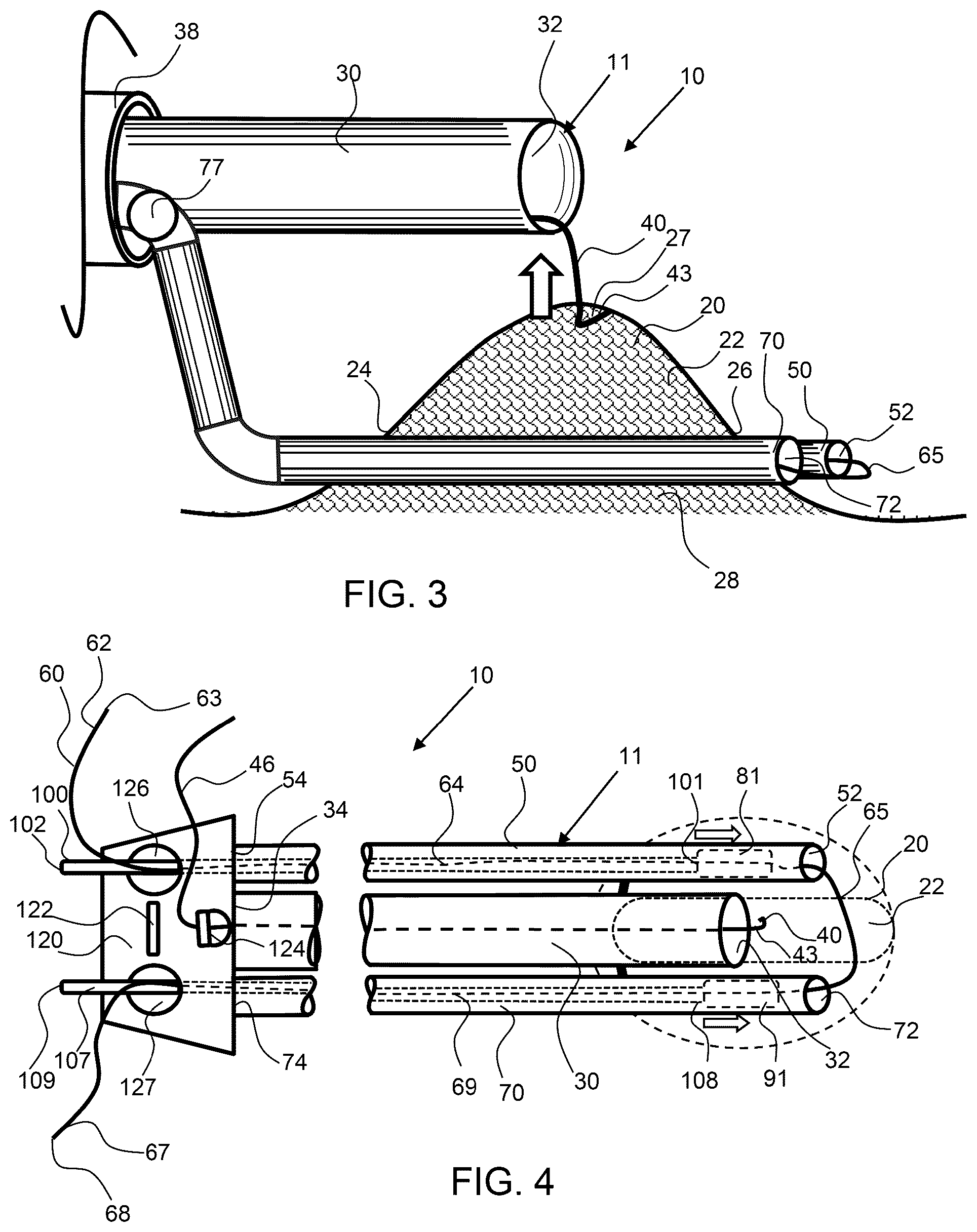 Patent US12303115 Figure 2 – Endoscopic tissue inversion and resection system and method of resecting tissue