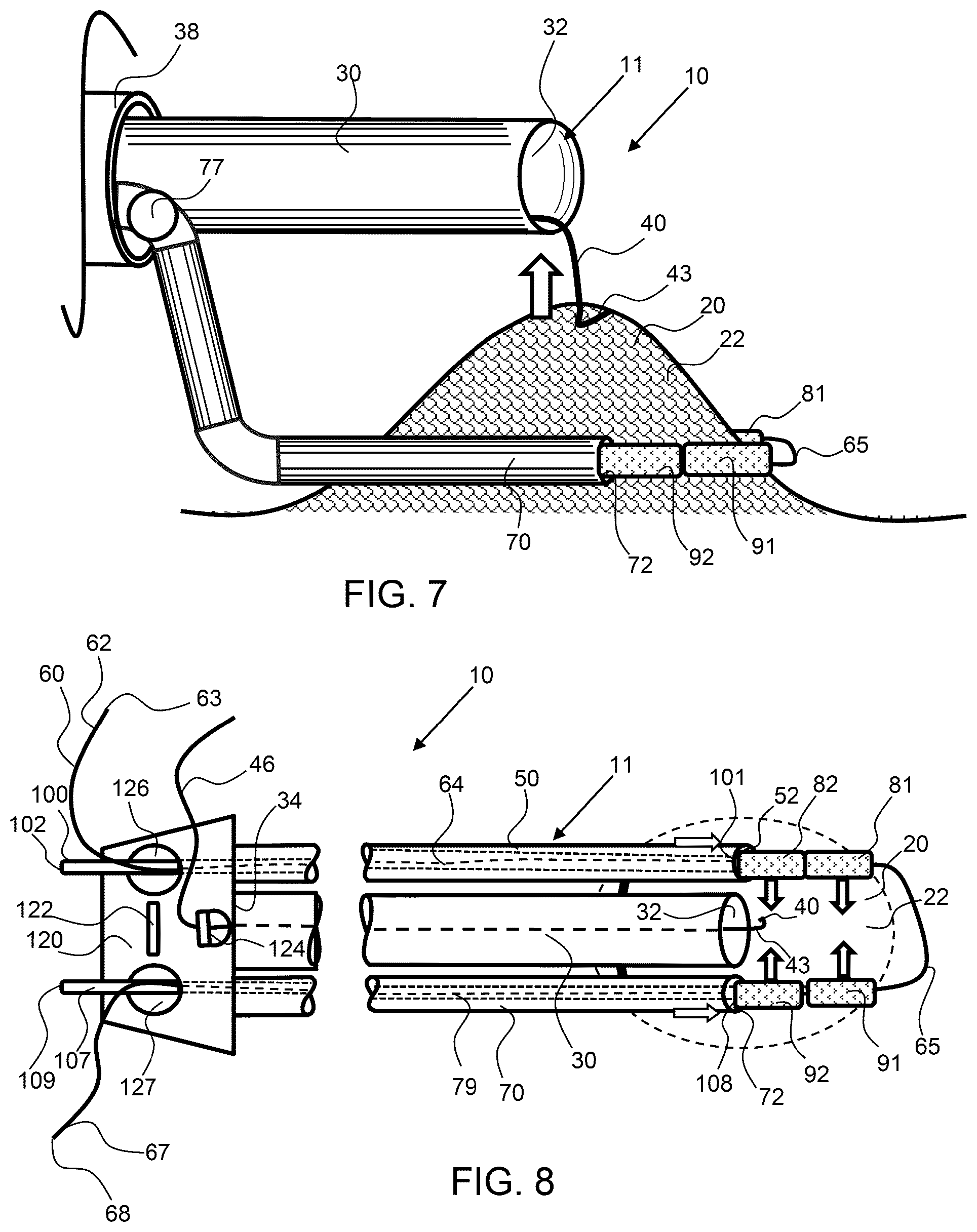 Patent US12303115 Figure 4 – Endoscopic tissue inversion and resection system and method of resecting tissue