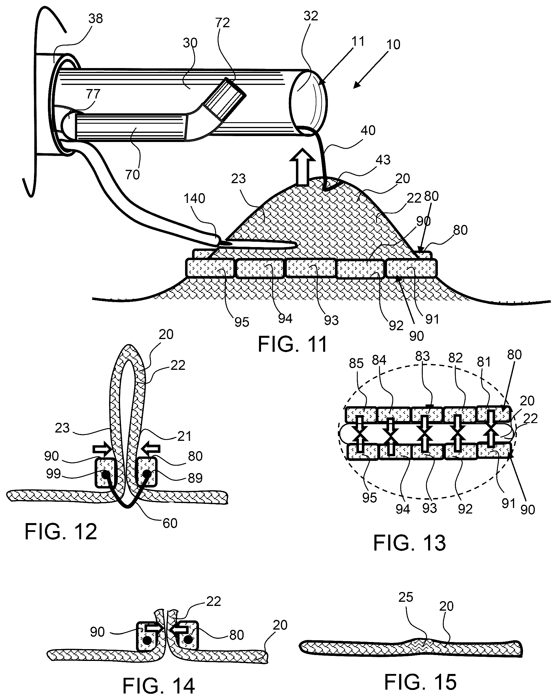 Patent US12303115 Figure 6 – Endoscopic tissue inversion and resection system and method of resecting tissue