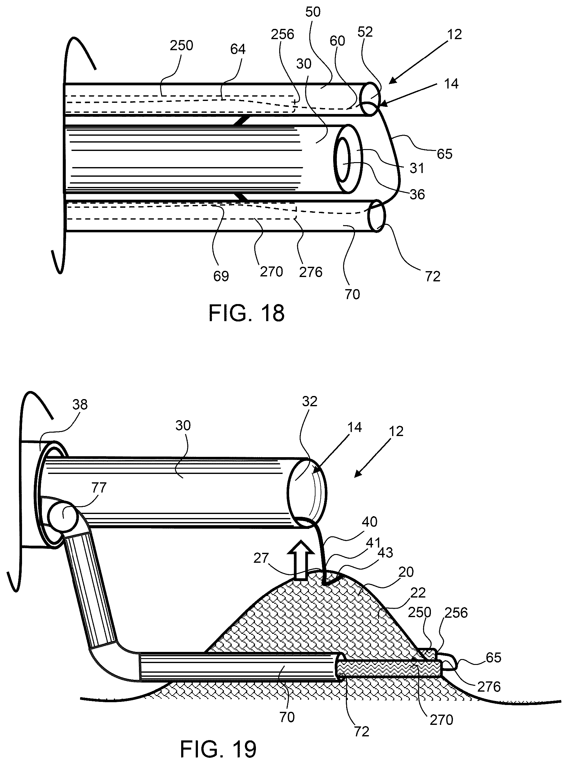 Patent US12303115 Figure 8 – Endoscopic tissue inversion and resection system and method of resecting tissue