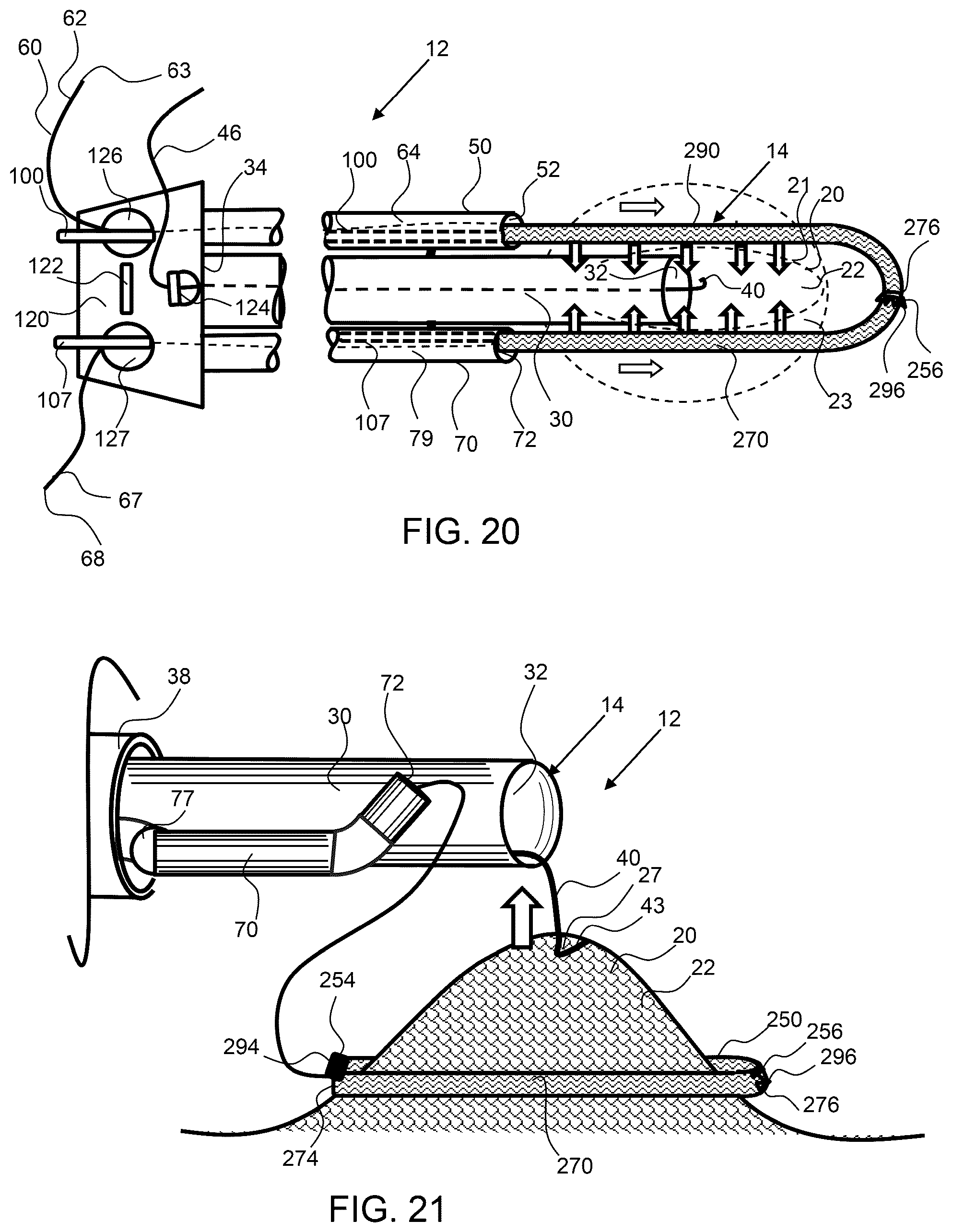 Patent US12303115 Figure 9 – Endoscopic tissue inversion and resection system and method of resecting tissue