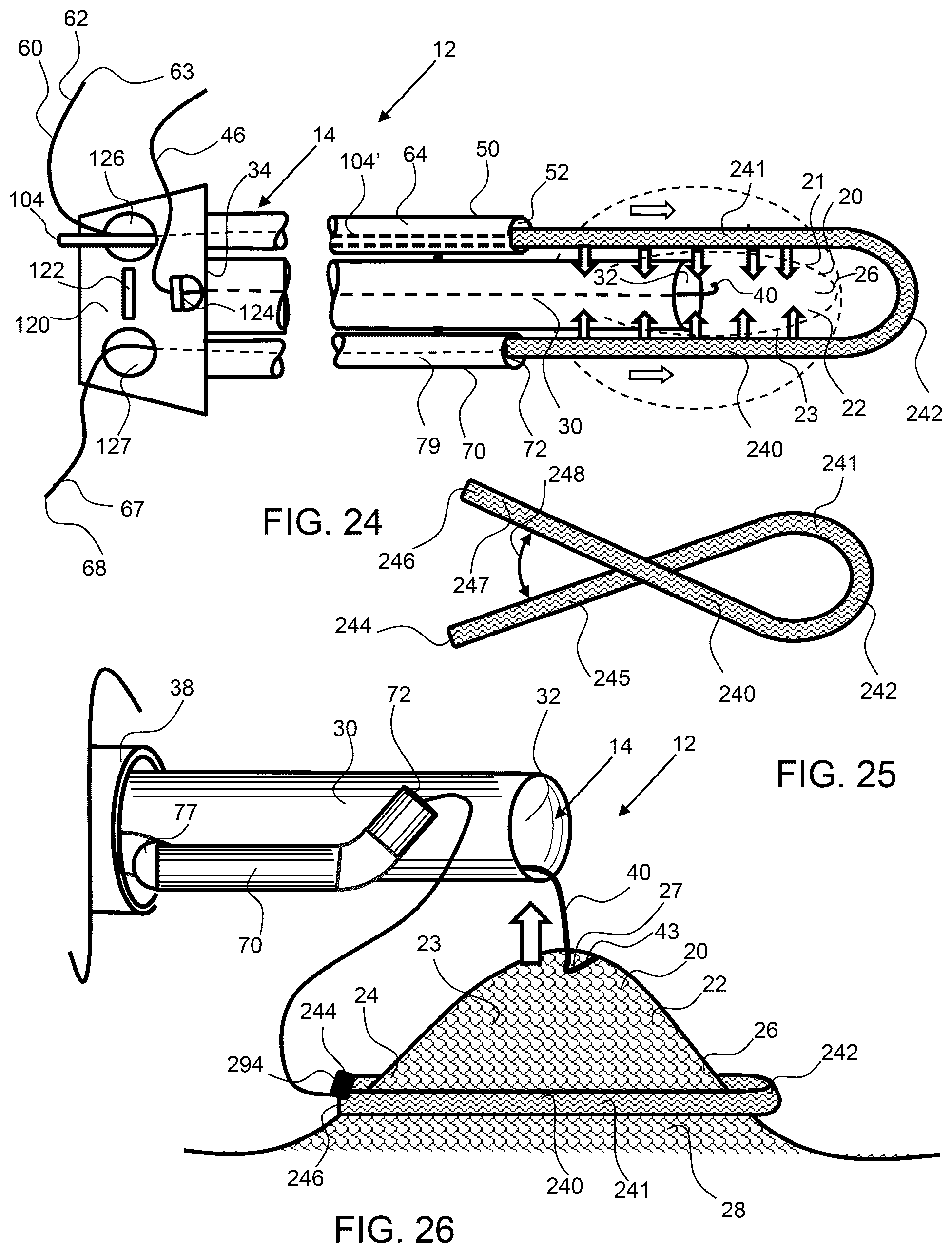 Patent US12303115 Figure 11 – Endoscopic tissue inversion and resection system and method of resecting tissue
