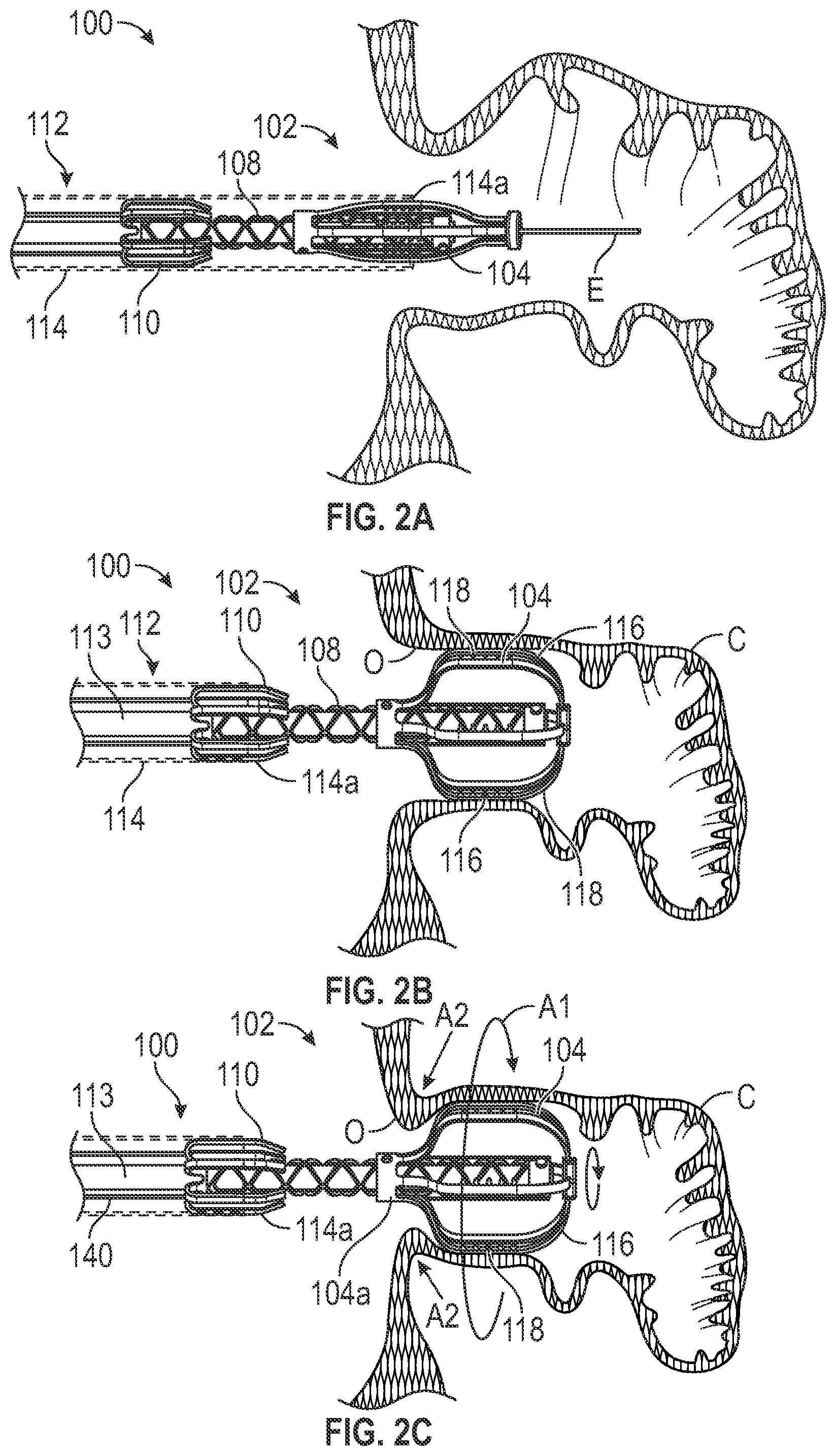 Patent US12303116 Figure 2 – Devices, systems, and methods for occluding cavities within the body