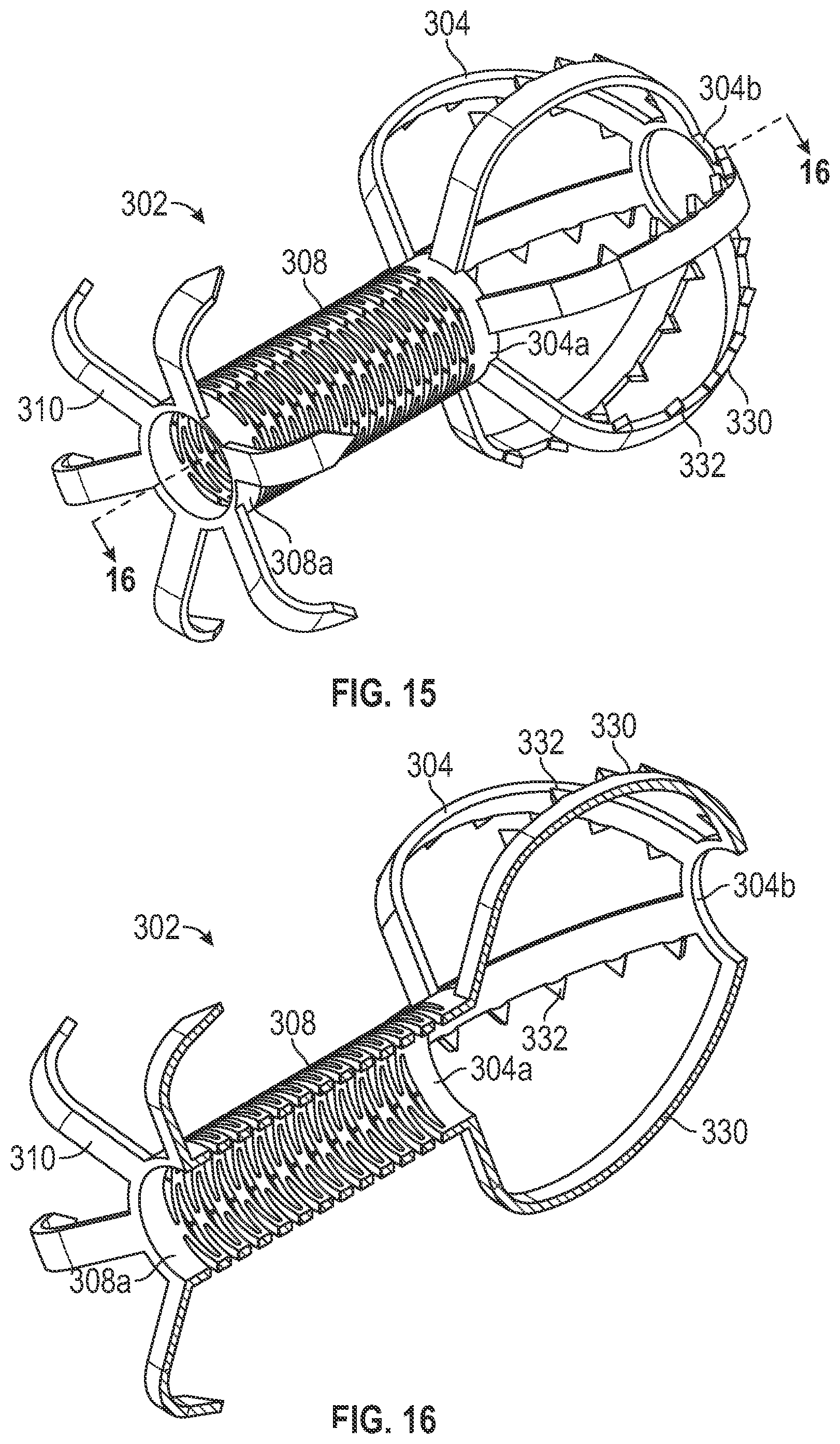 Patent US12303116 Figure 14 – Devices, systems, and methods for occluding cavities within the body