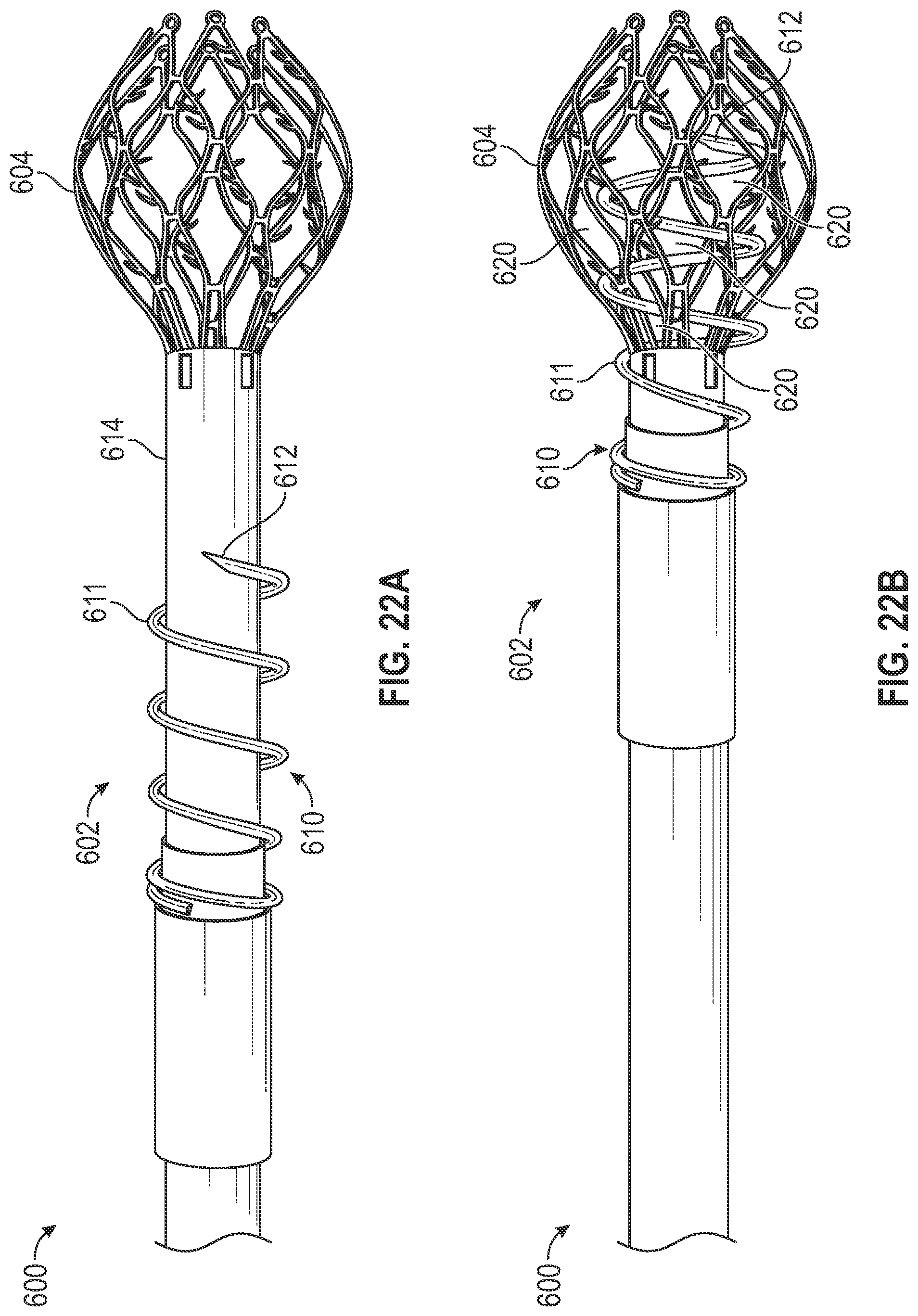 Patent US12303116 Figure 17 – Devices, systems, and methods for occluding cavities within the body