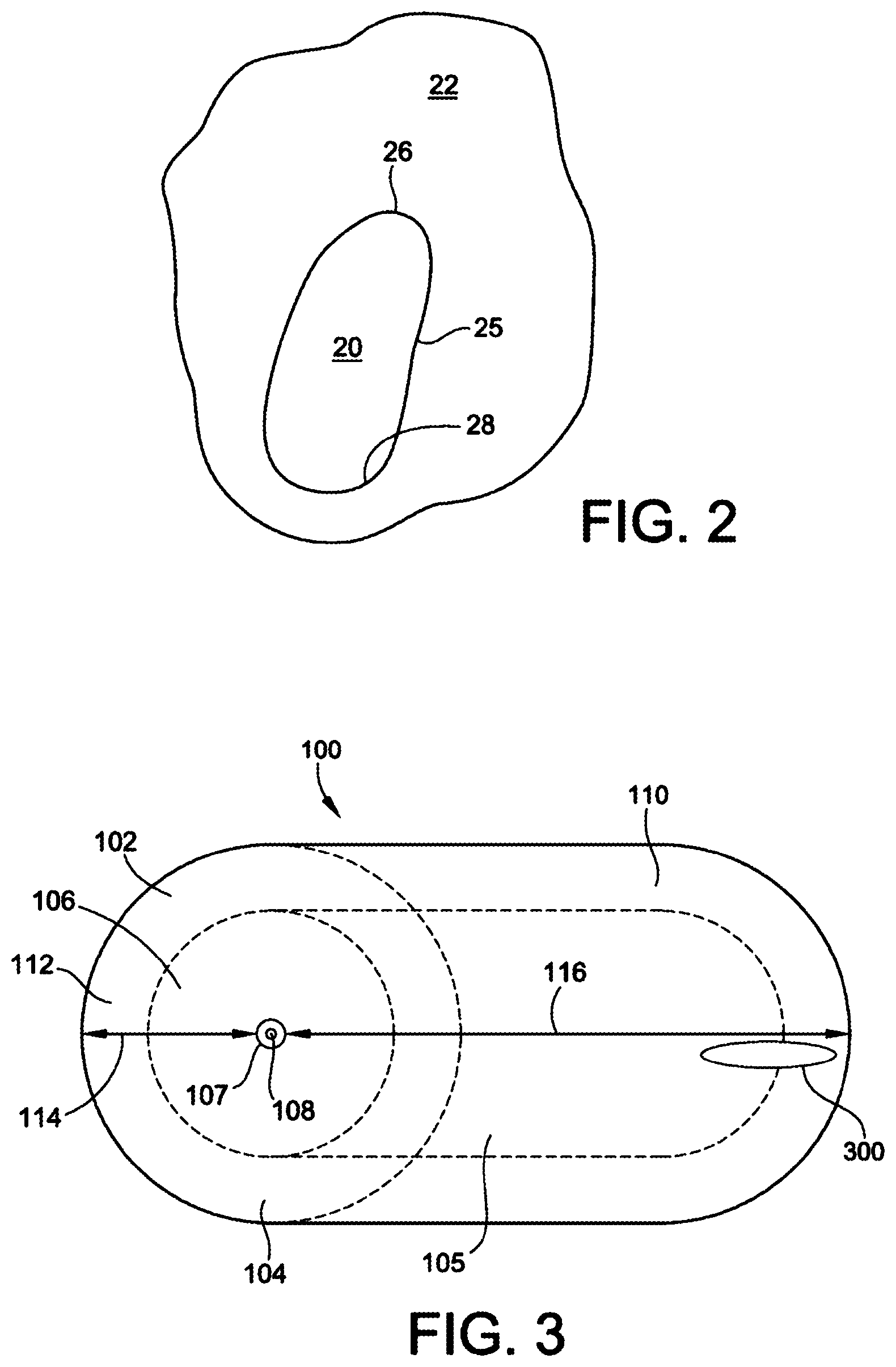 Patent US12303117 Figure 2 – Asymmetric occluder device