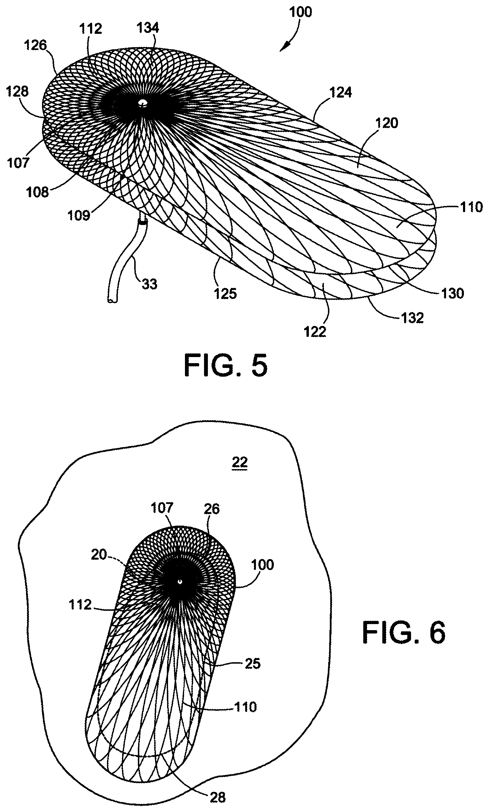 Patent US12303117 Figure 4 – Asymmetric occluder device