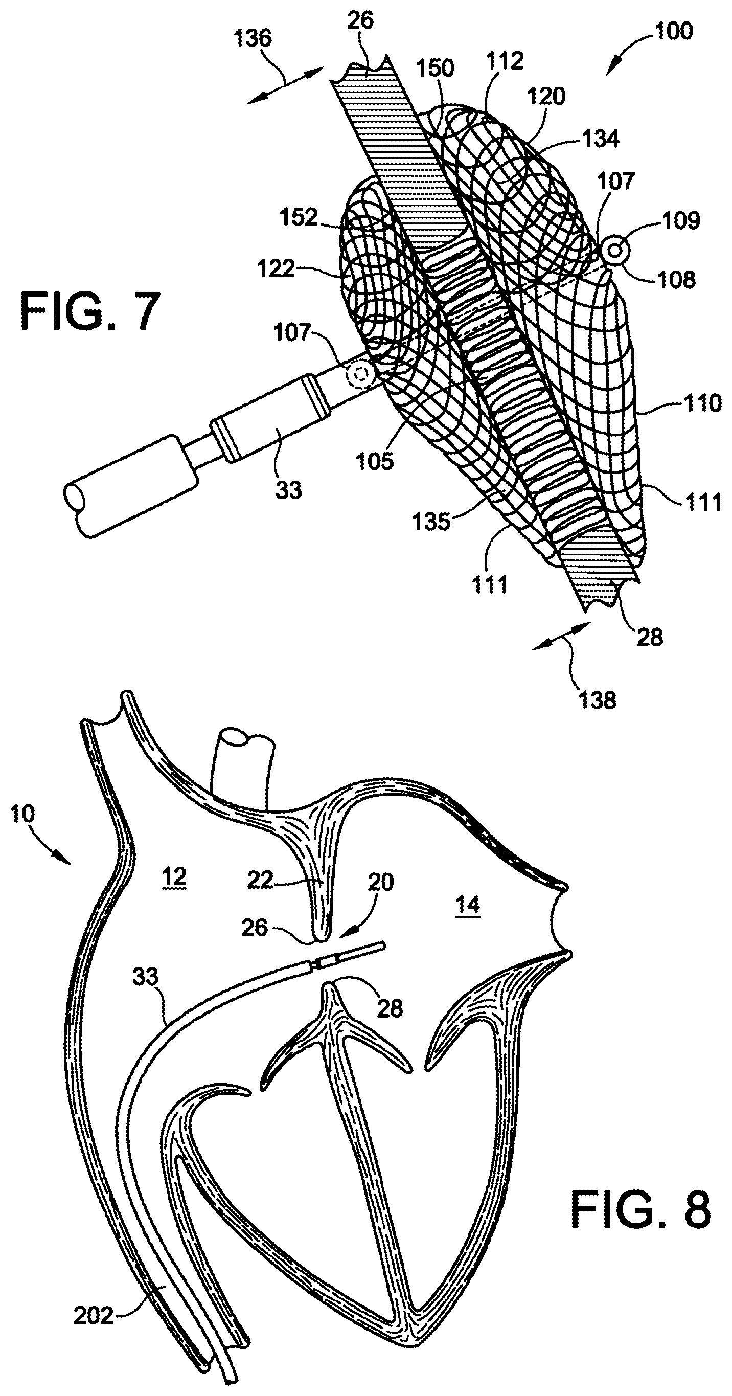 Patent US12303117 Figure 5 – Asymmetric occluder device