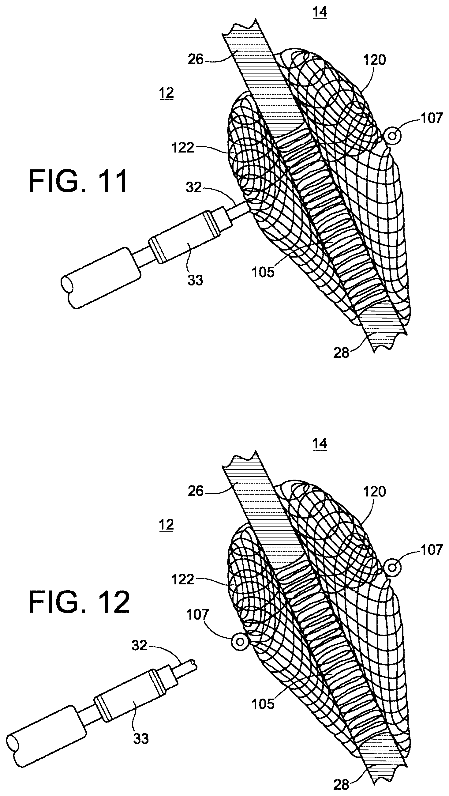 Patent US12303117 Figure 7 – Asymmetric occluder device