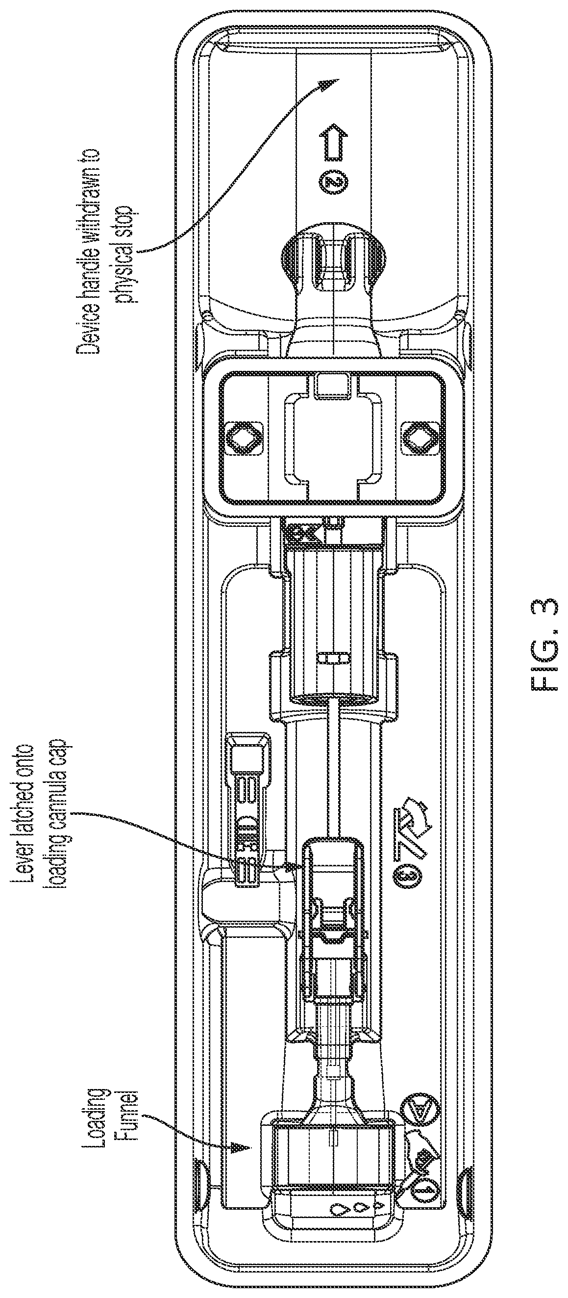 Patent US12303118 Figure 4 – Vascular closure device