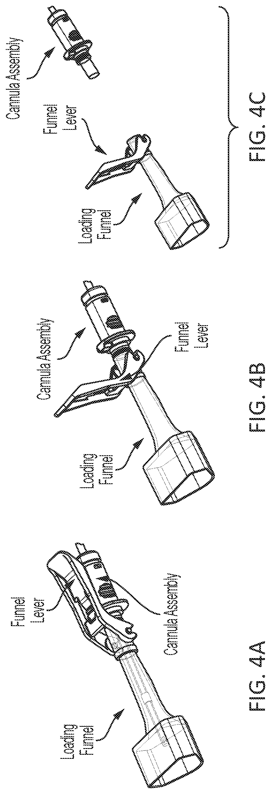Patent US12303118 Figure 5 – Vascular closure device
