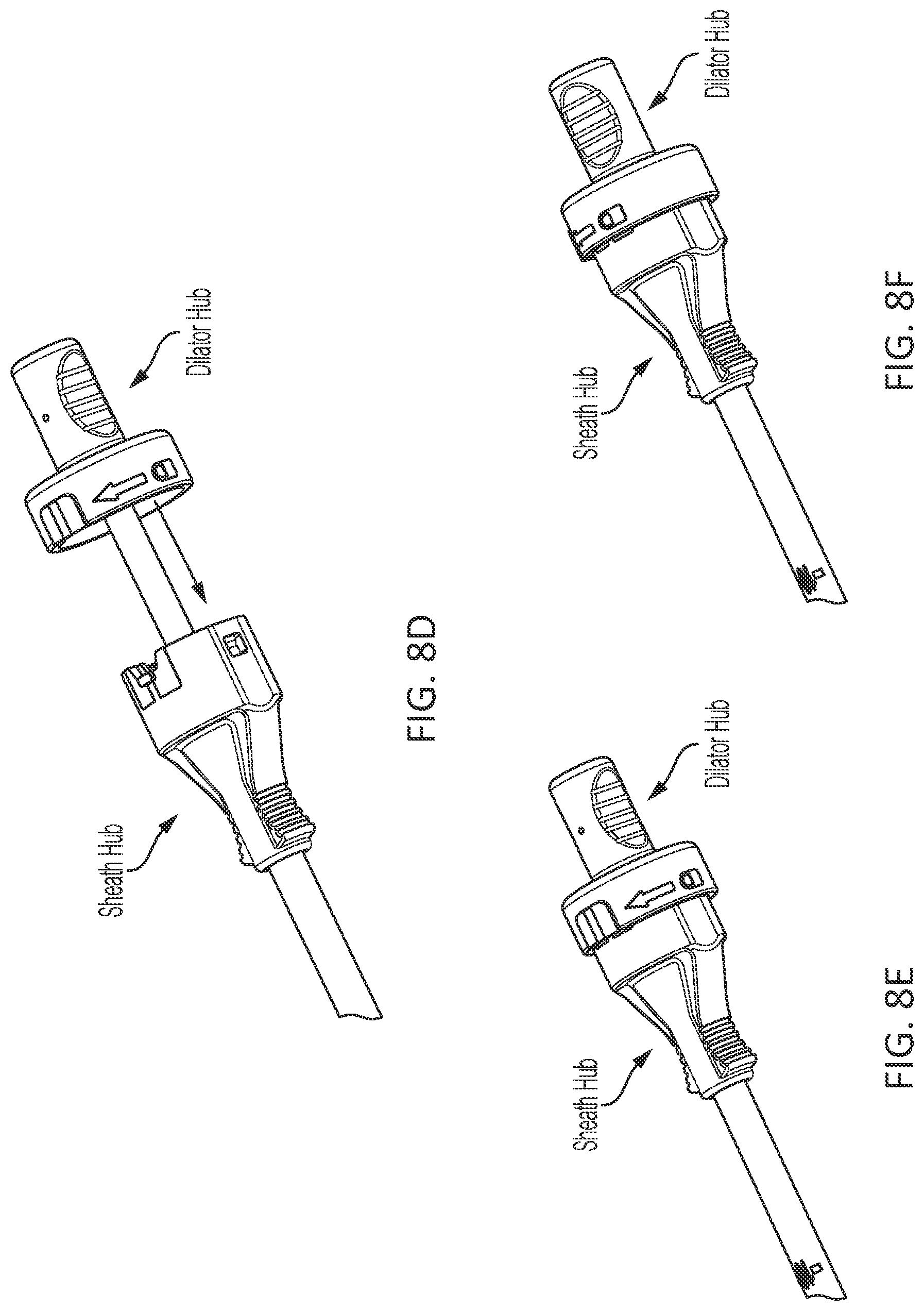 Patent US12303118 Figure 12 – Vascular closure device