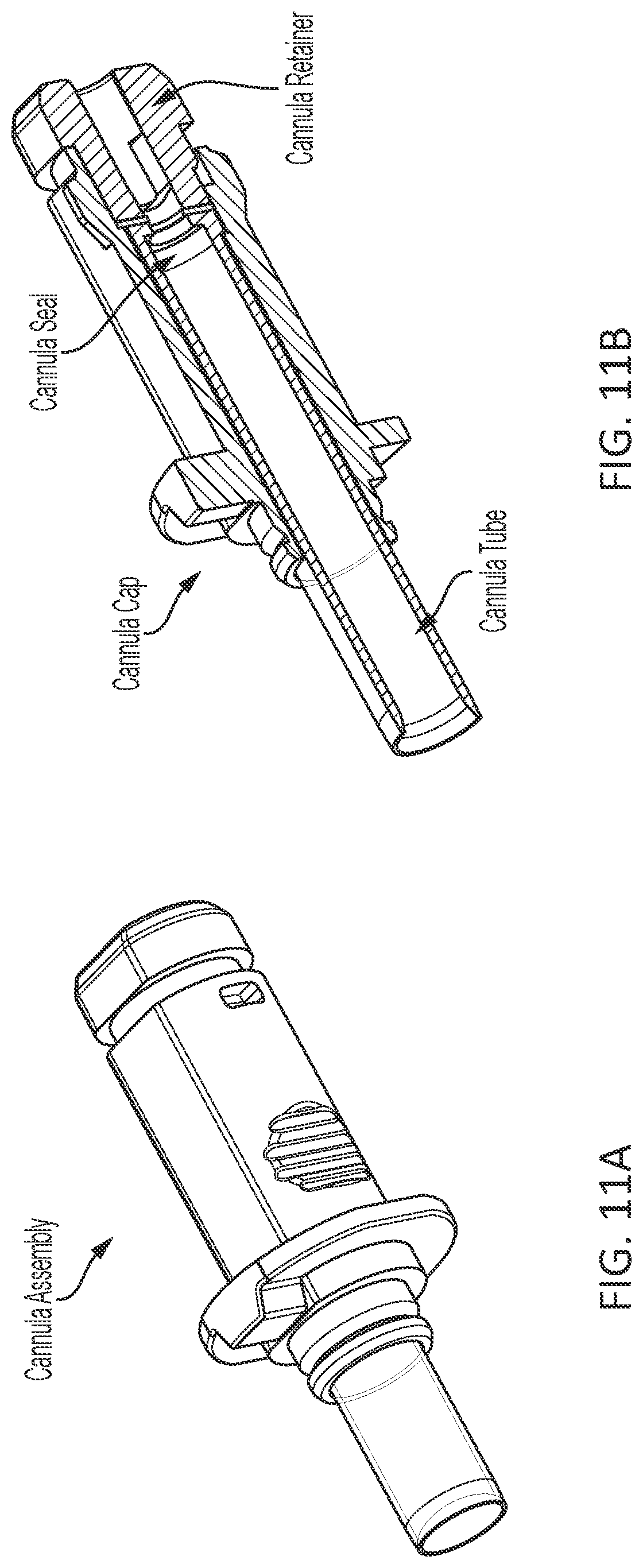 Patent US12303118 Figure 17 – Vascular closure device