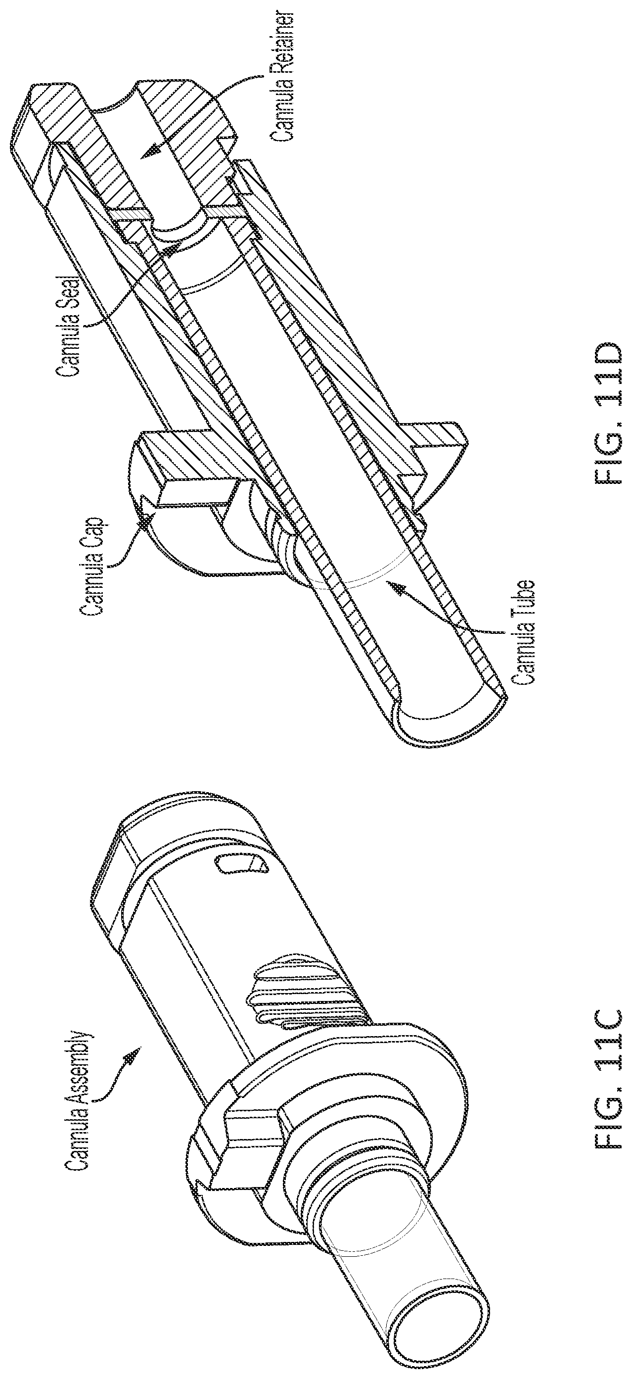 Patent US12303118 Figure 18 – Vascular closure device