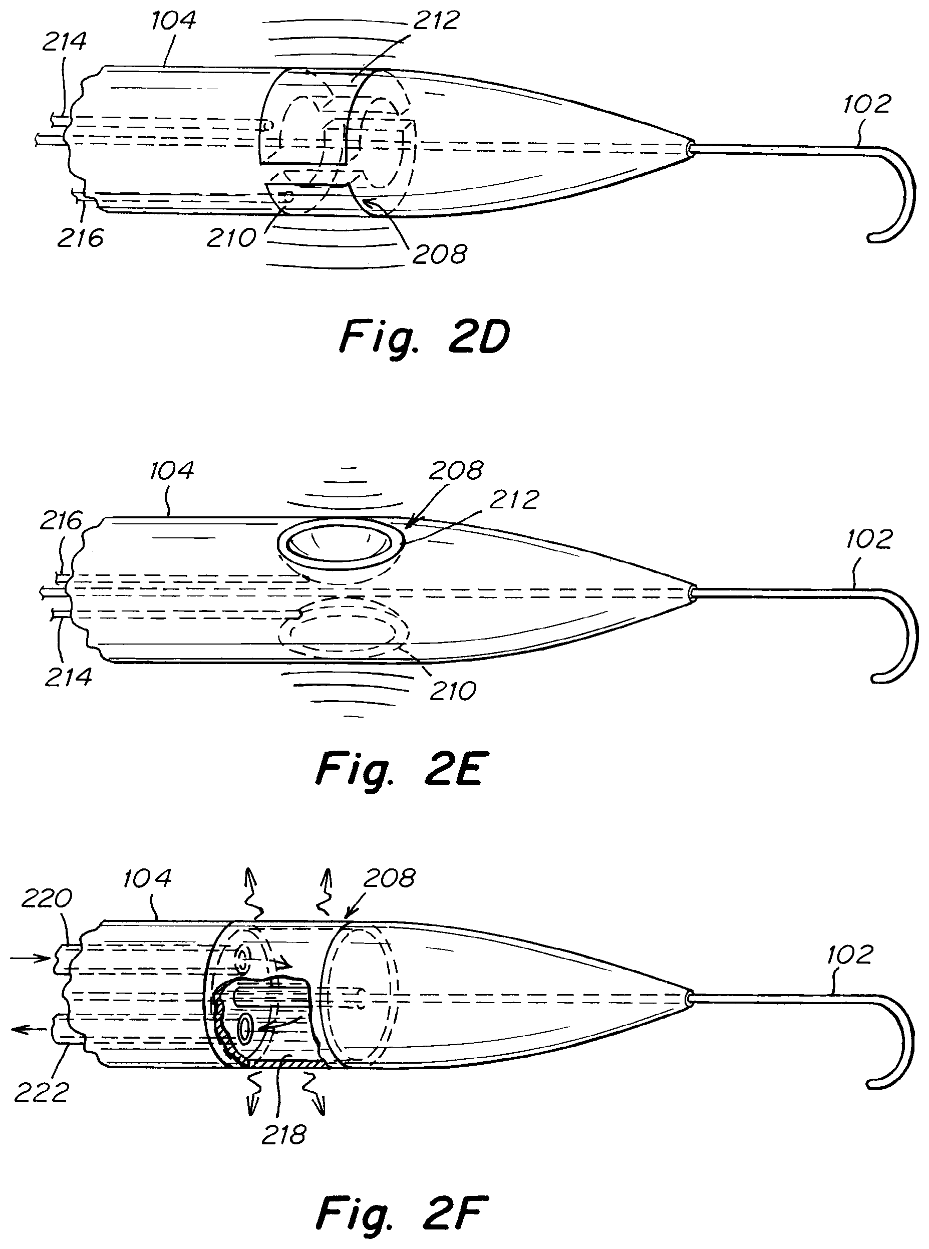 Patent US12303119 Figure 3 – Apparatus and methods to create and maintain an intra-atrial pressure relief opening