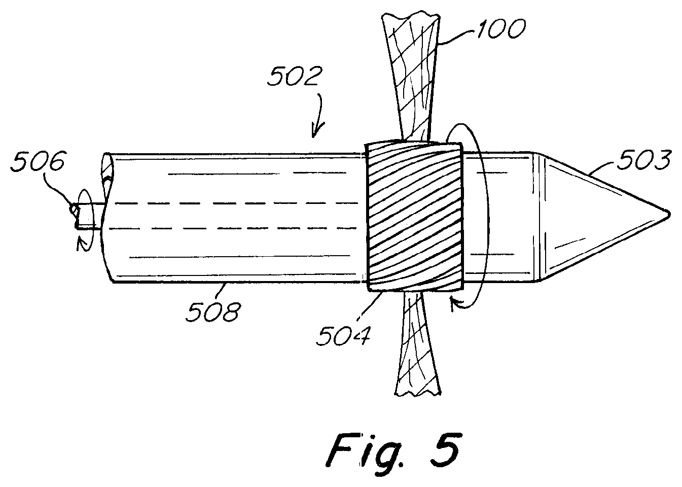 Patent US12303119 Figure 8 – Apparatus and methods to create and maintain an intra-atrial pressure relief opening
