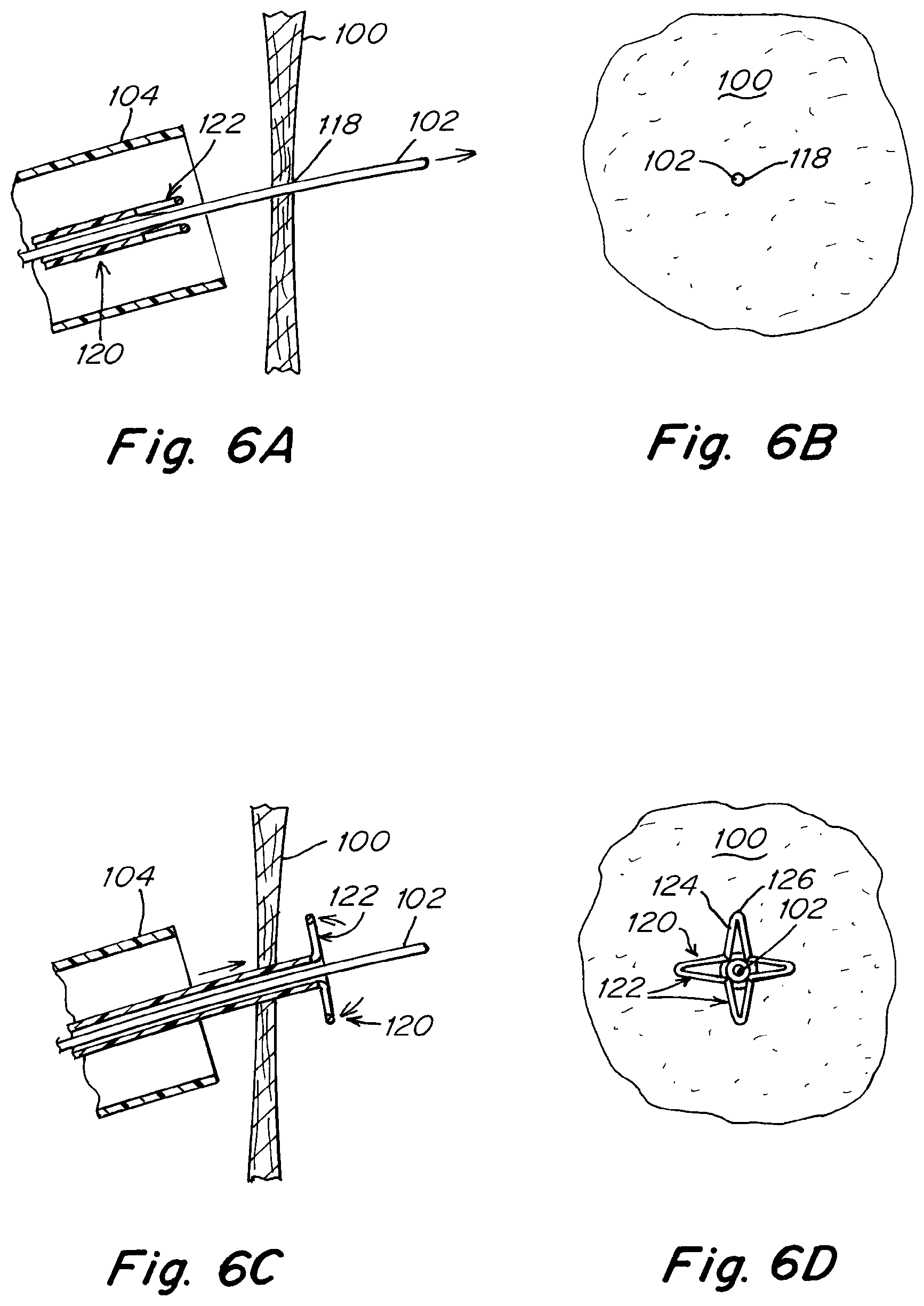 Patent US12303119 Figure 9 – Apparatus and methods to create and maintain an intra-atrial pressure relief opening