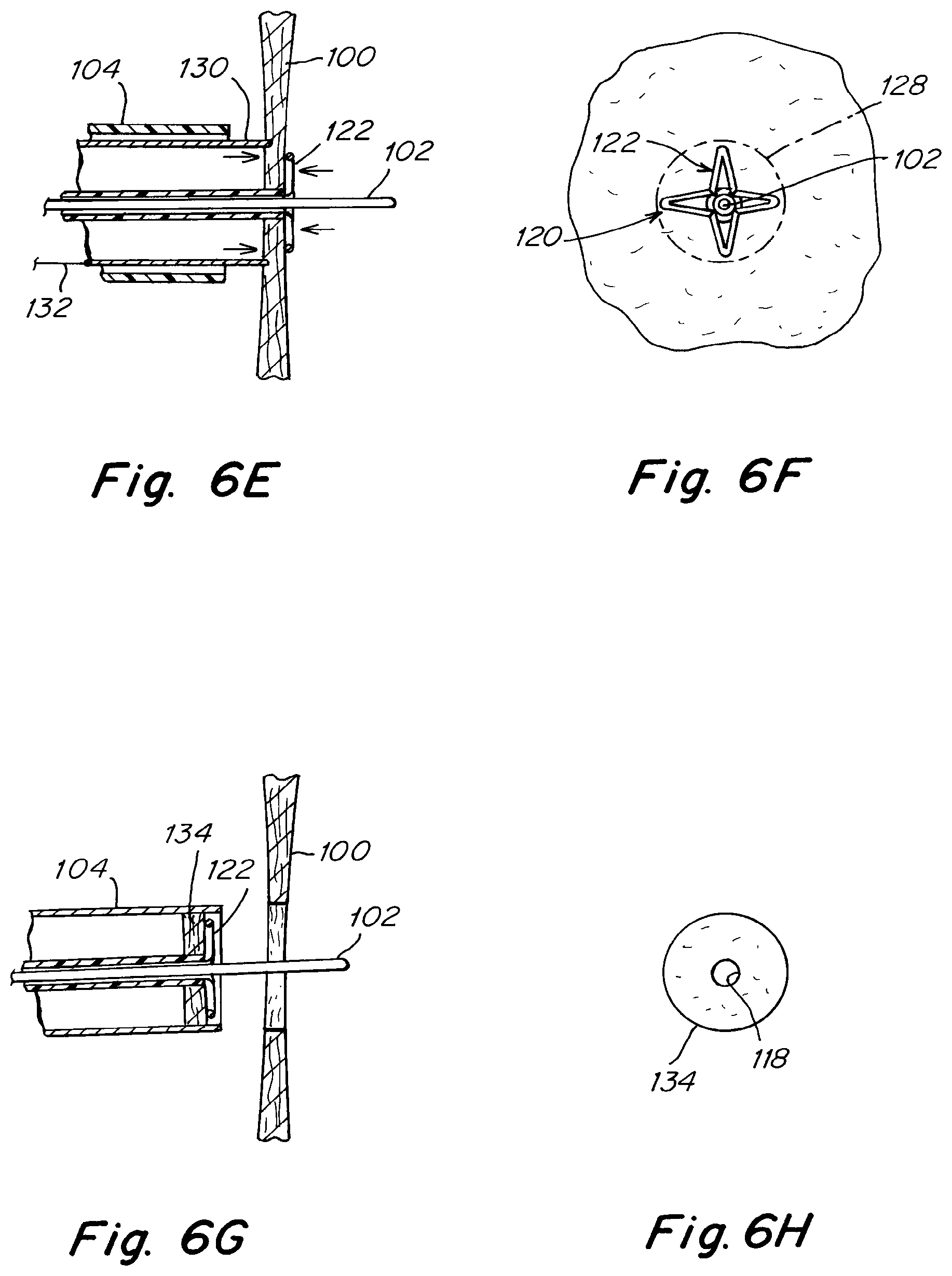 Patent US12303119 Figure 10 – Apparatus and methods to create and maintain an intra-atrial pressure relief opening