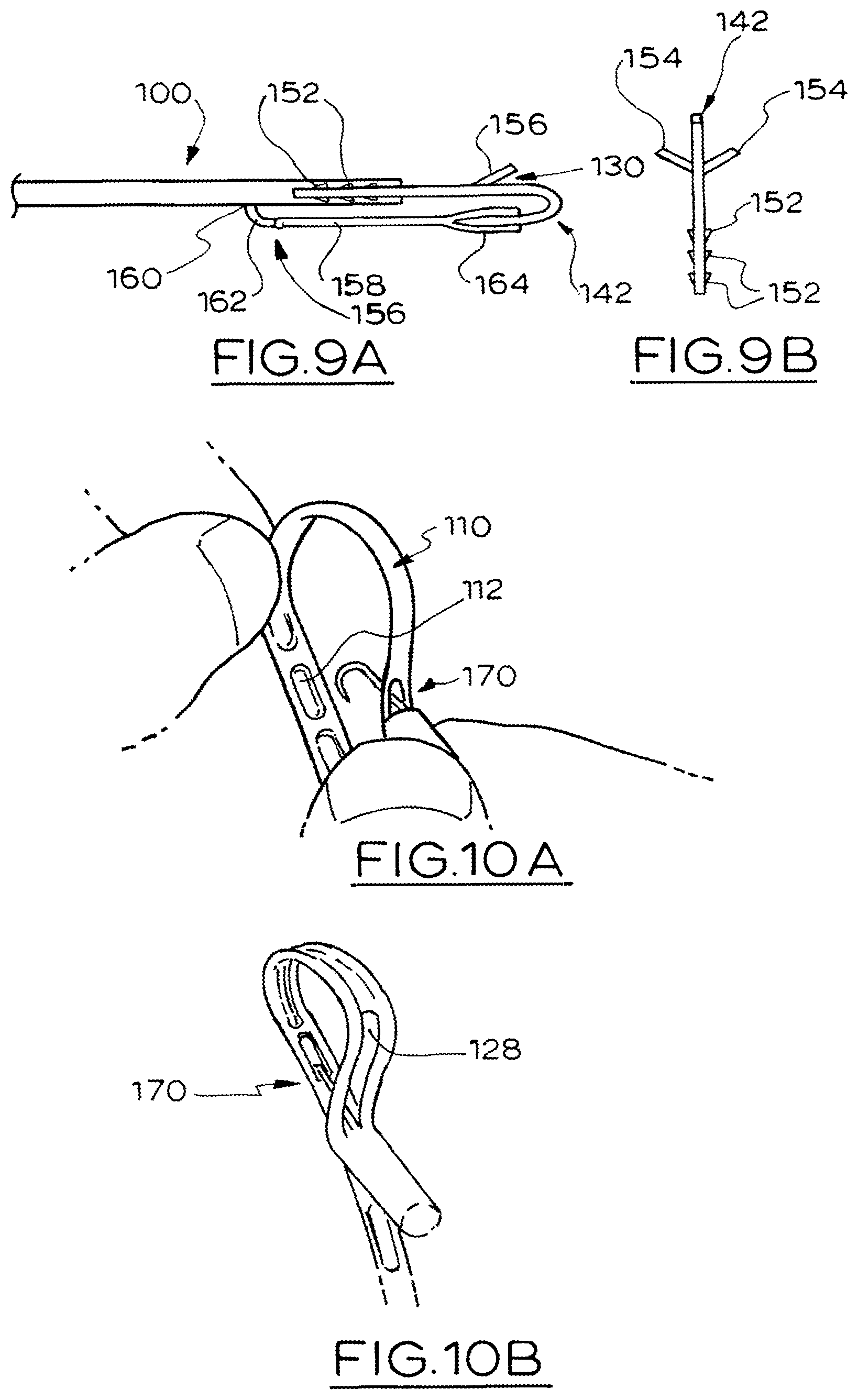 Patent US12303120 Figure 3 – Hook and fenestration retractor