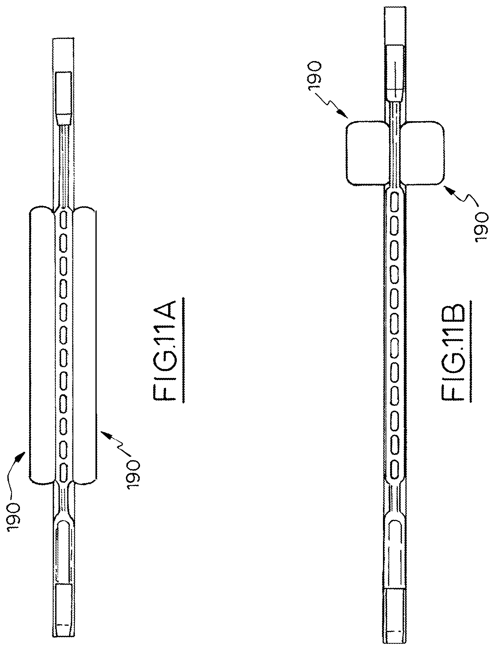 Patent US12303120 Figure 4 – Hook and fenestration retractor
