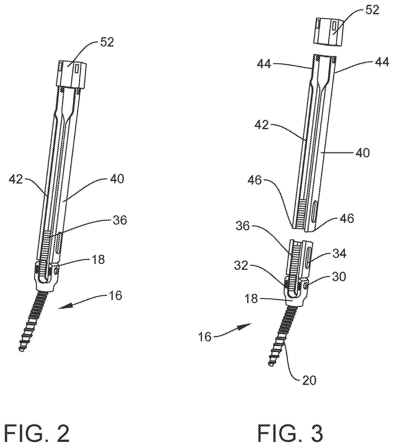 Patent US12303121 Figure 2 – Surgical system and method