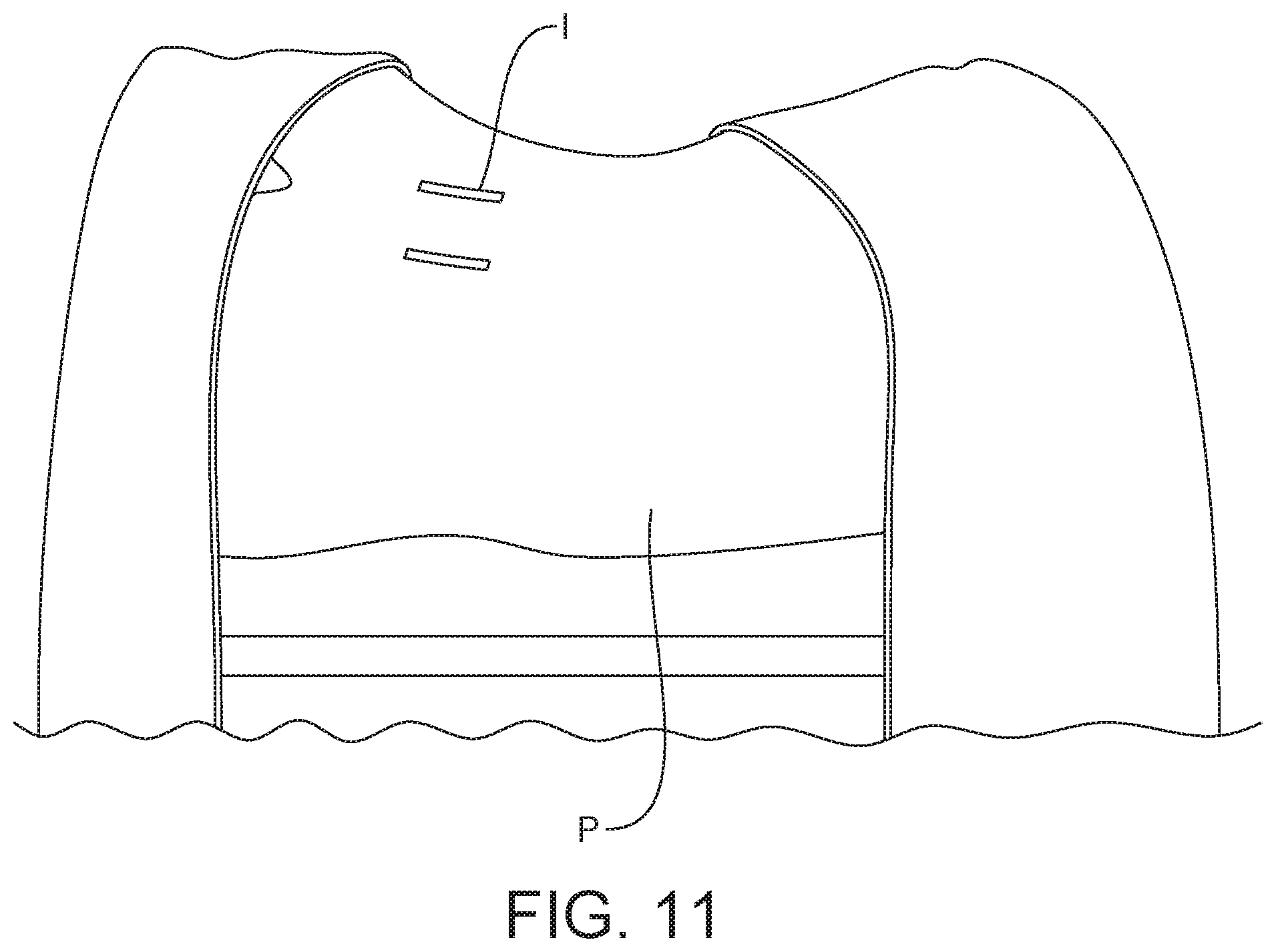 Patent US12303121 Figure 8 – Surgical system and method