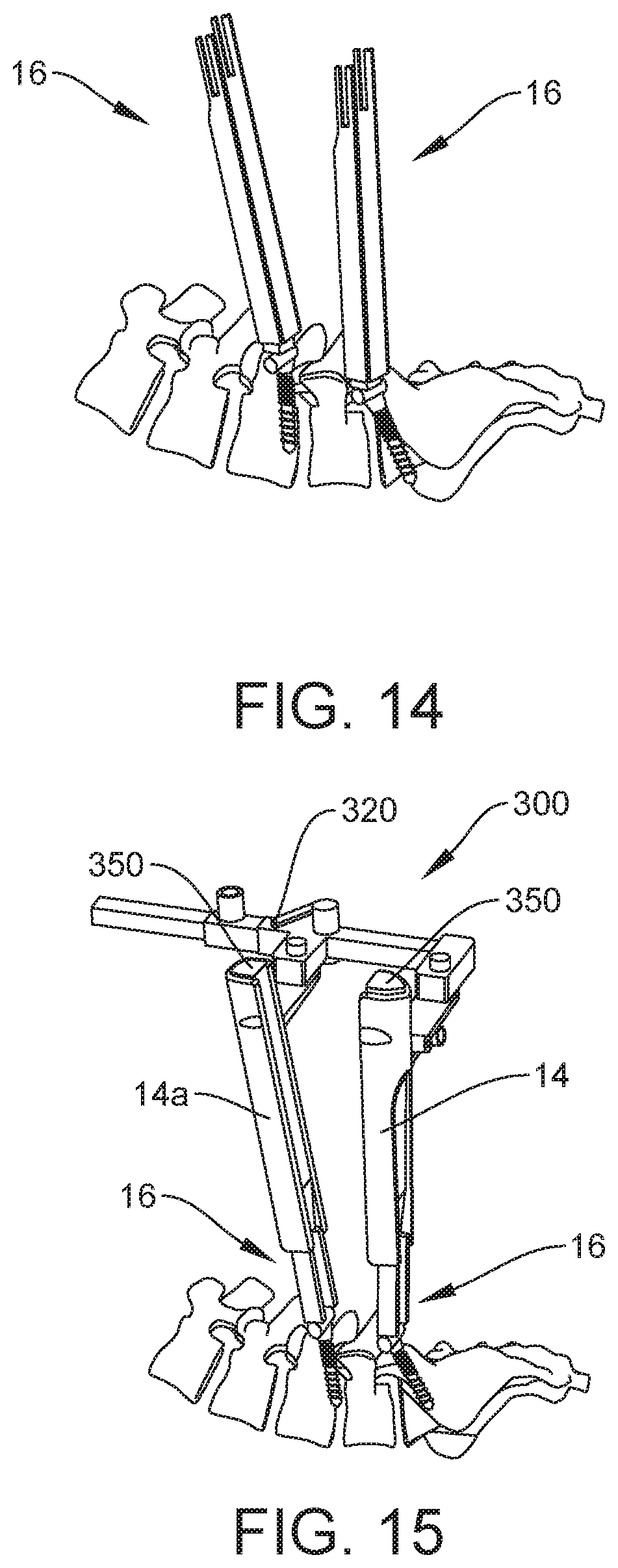 Patent US12303121 Figure 10 – Surgical system and method