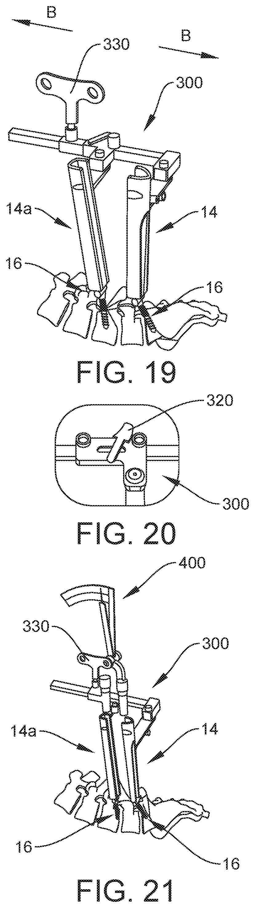 Patent US12303121 Figure 12 – Surgical system and method