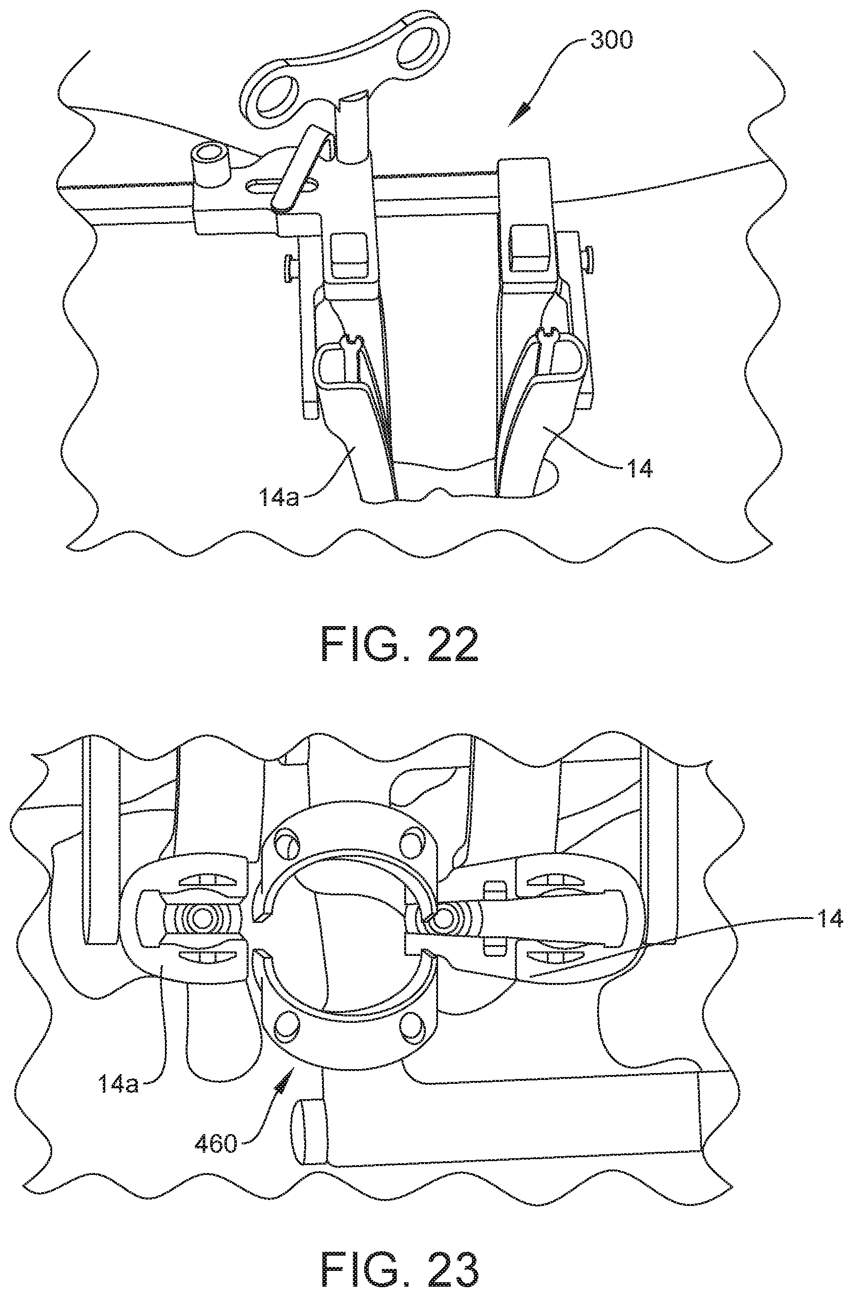Patent US12303121 Figure 13 – Surgical system and method