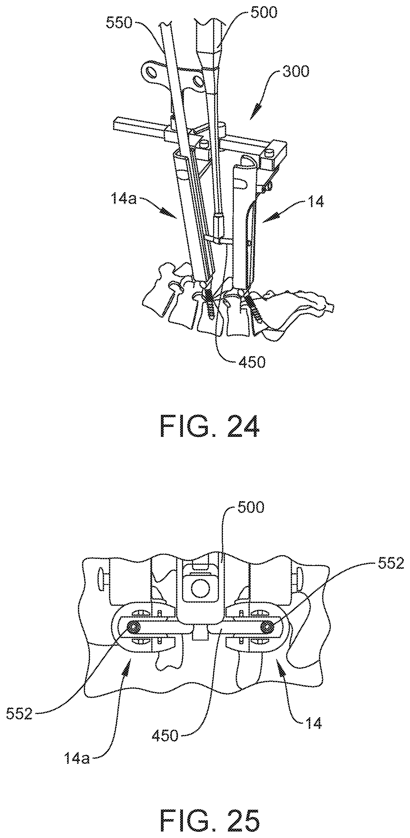 Patent US12303121 Figure 14 – Surgical system and method