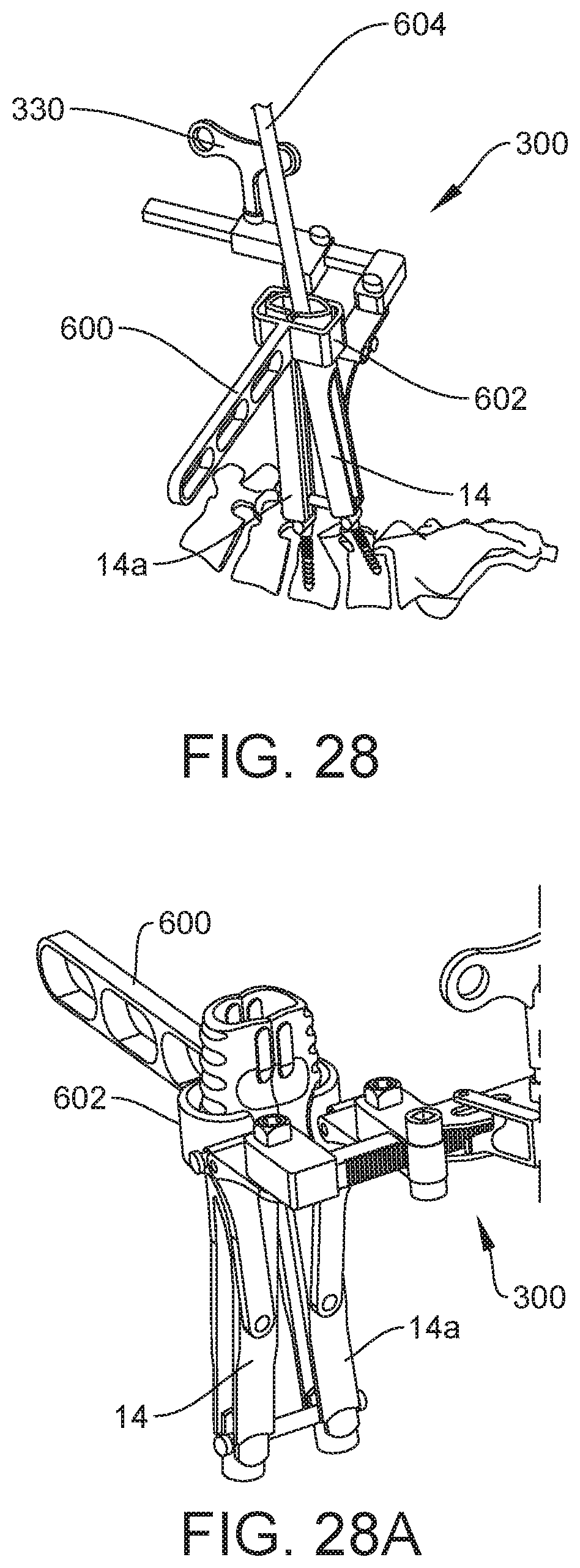 Patent US12303121 Figure 16 – Surgical system and method