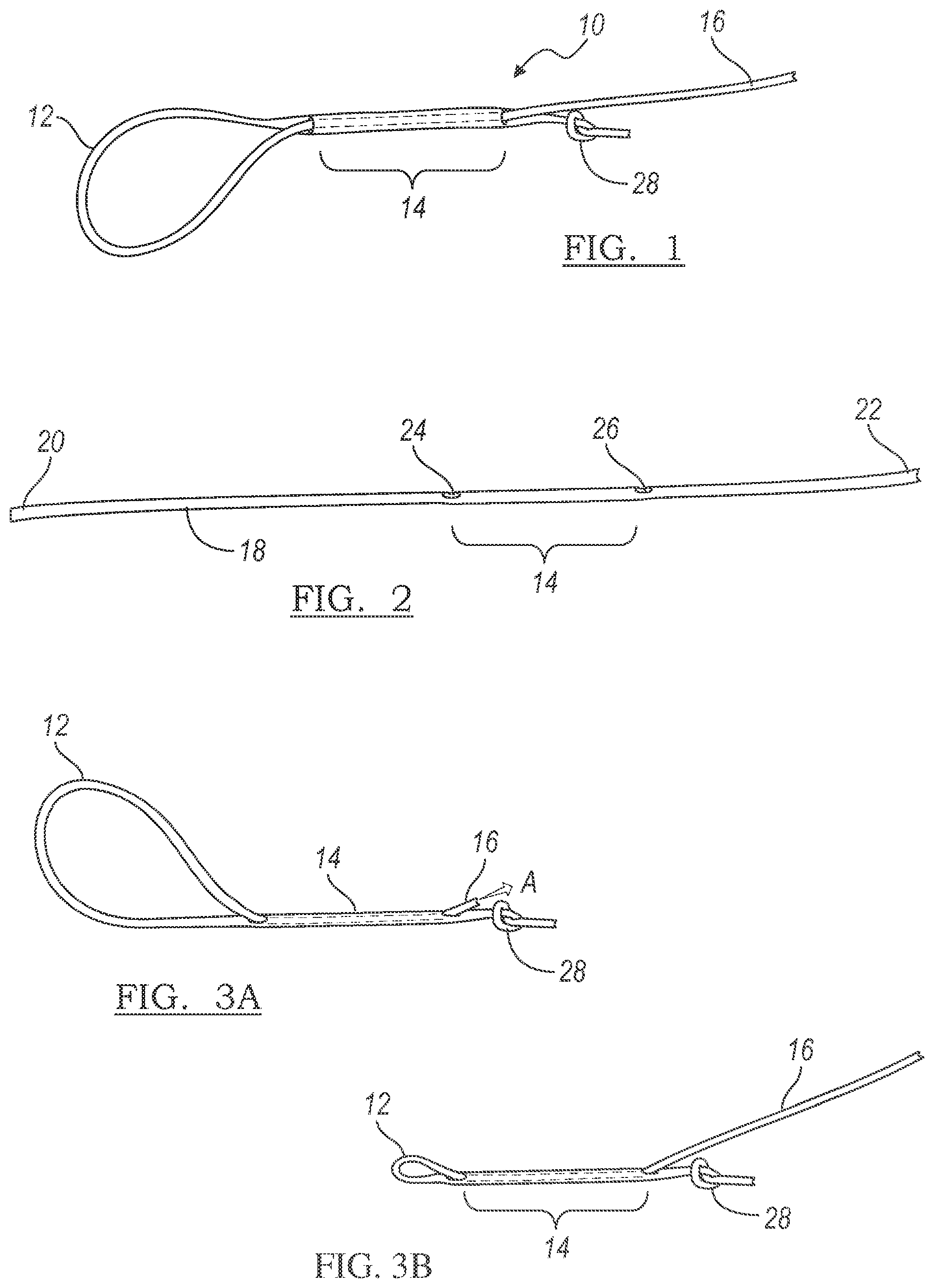 Patent US12303122 Figure 1 – Adjustable knotless loops