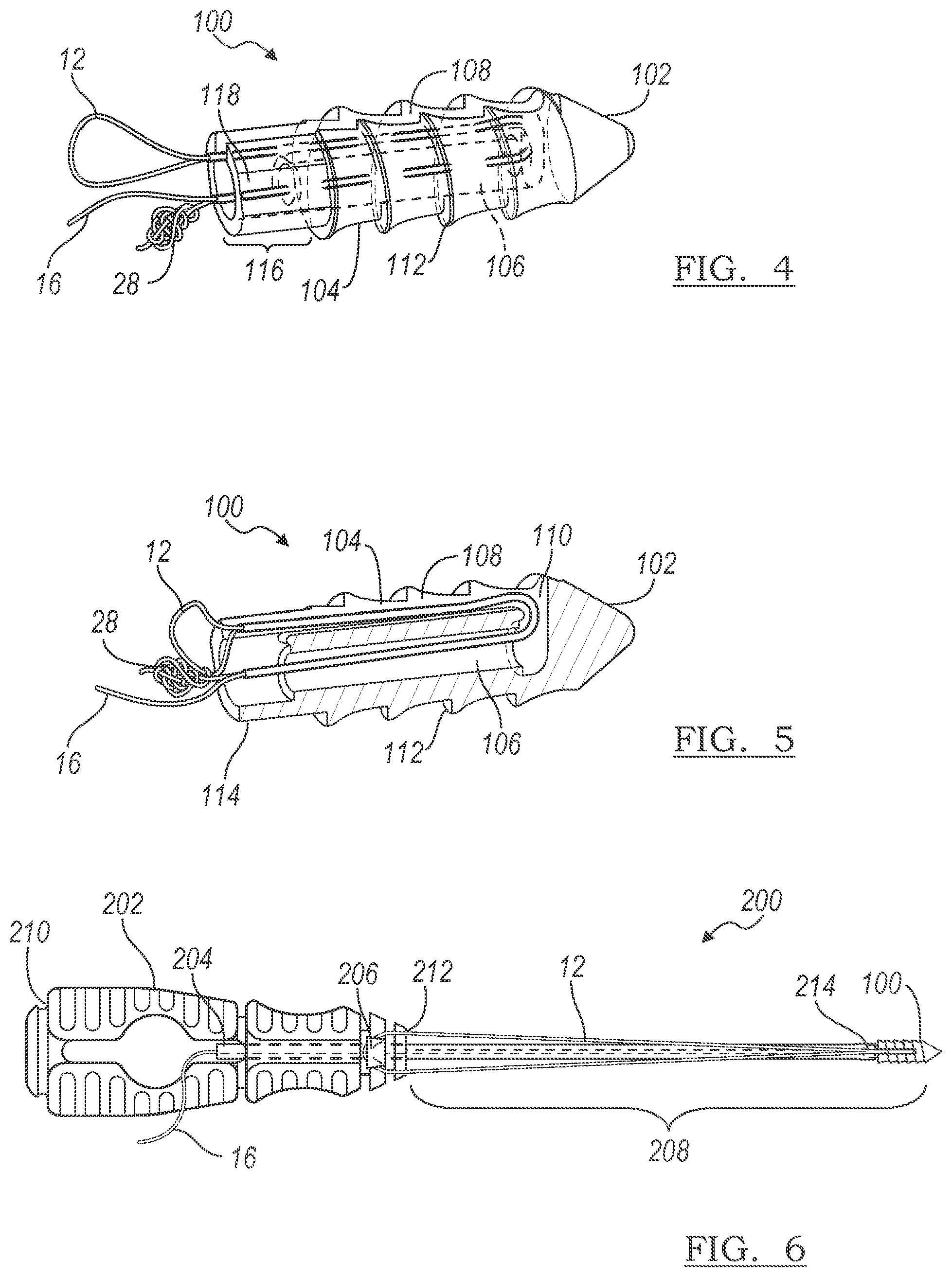 Patent US12303122 Figure 2 – Adjustable knotless loops