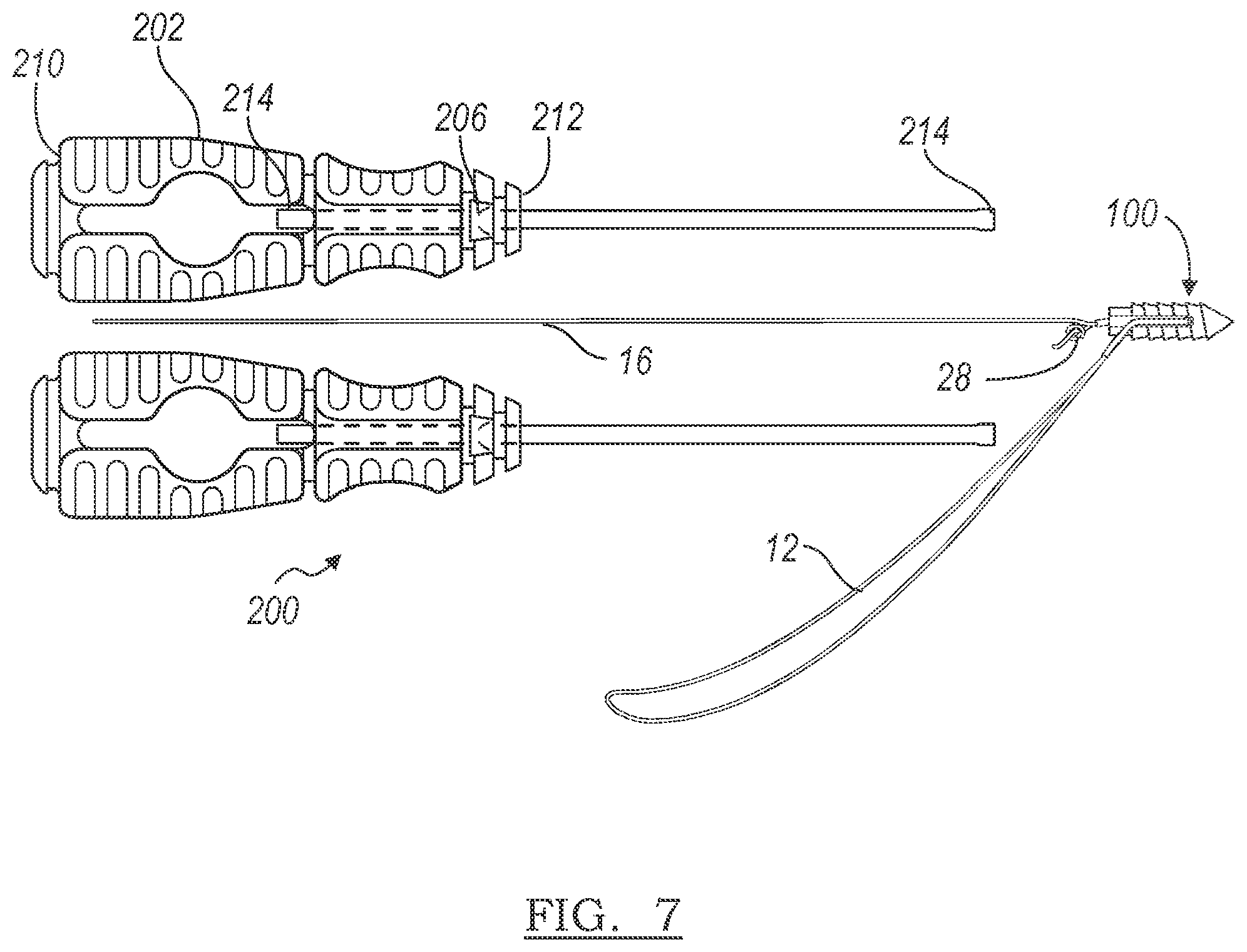 Patent US12303122 Figure 3 – Adjustable knotless loops