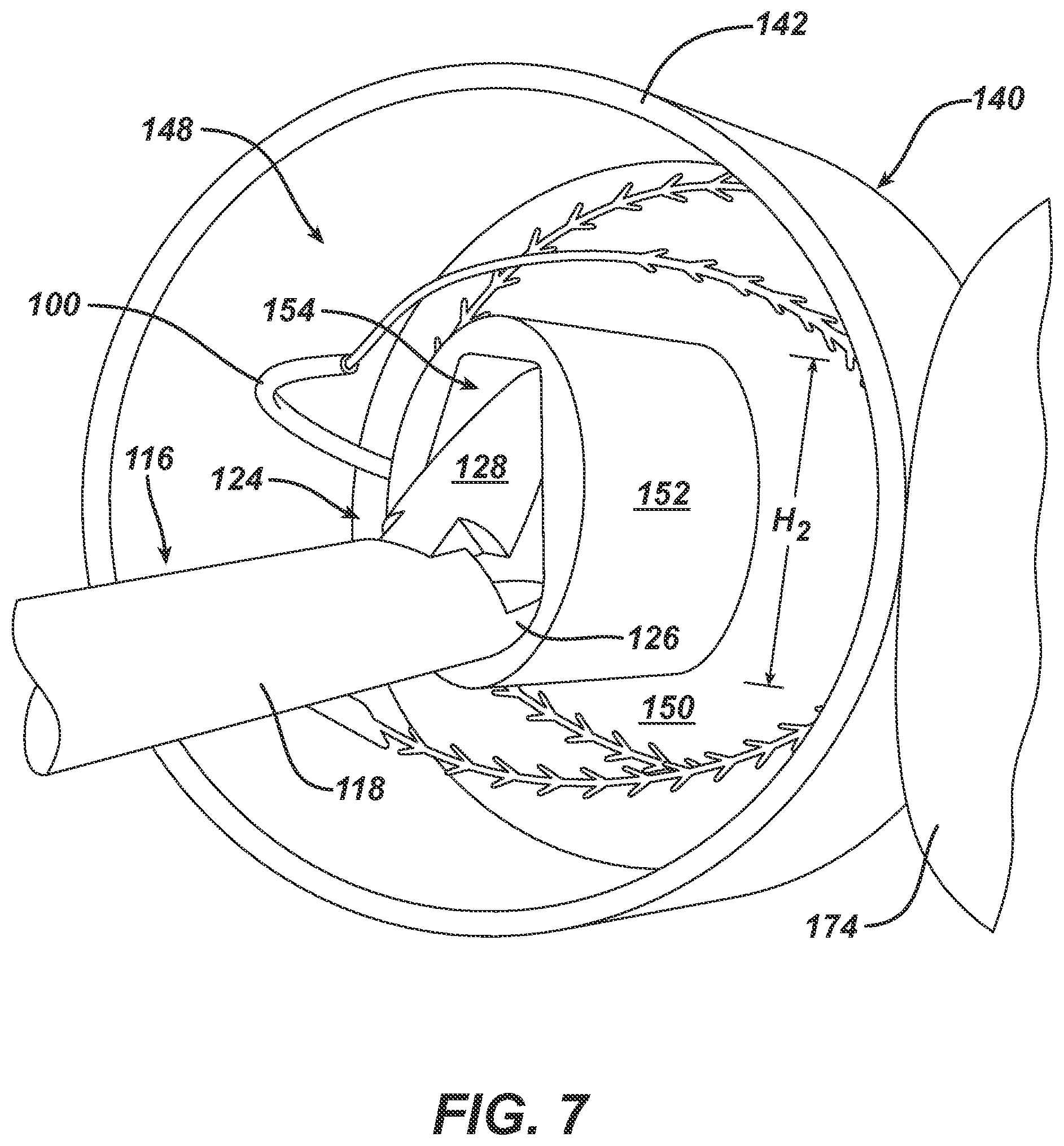Patent US12303125 Figure 11 – Methods, systems and devices for storing suture needles and using robotics for delivering selected suture needles to surgical sites