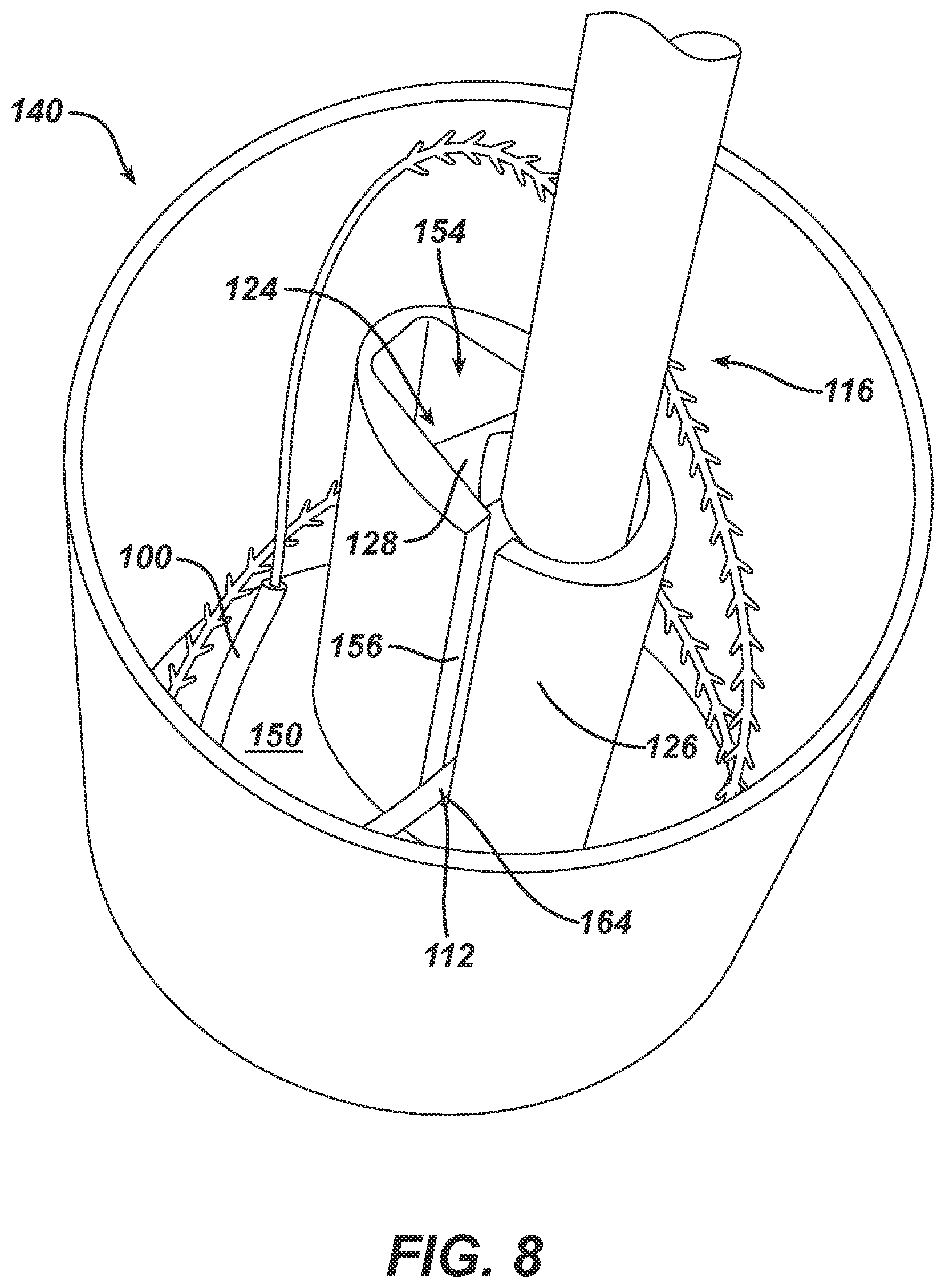 Patent US12303125 Figure 12 – Methods, systems and devices for storing suture needles and using robotics for delivering selected suture needles to surgical sites