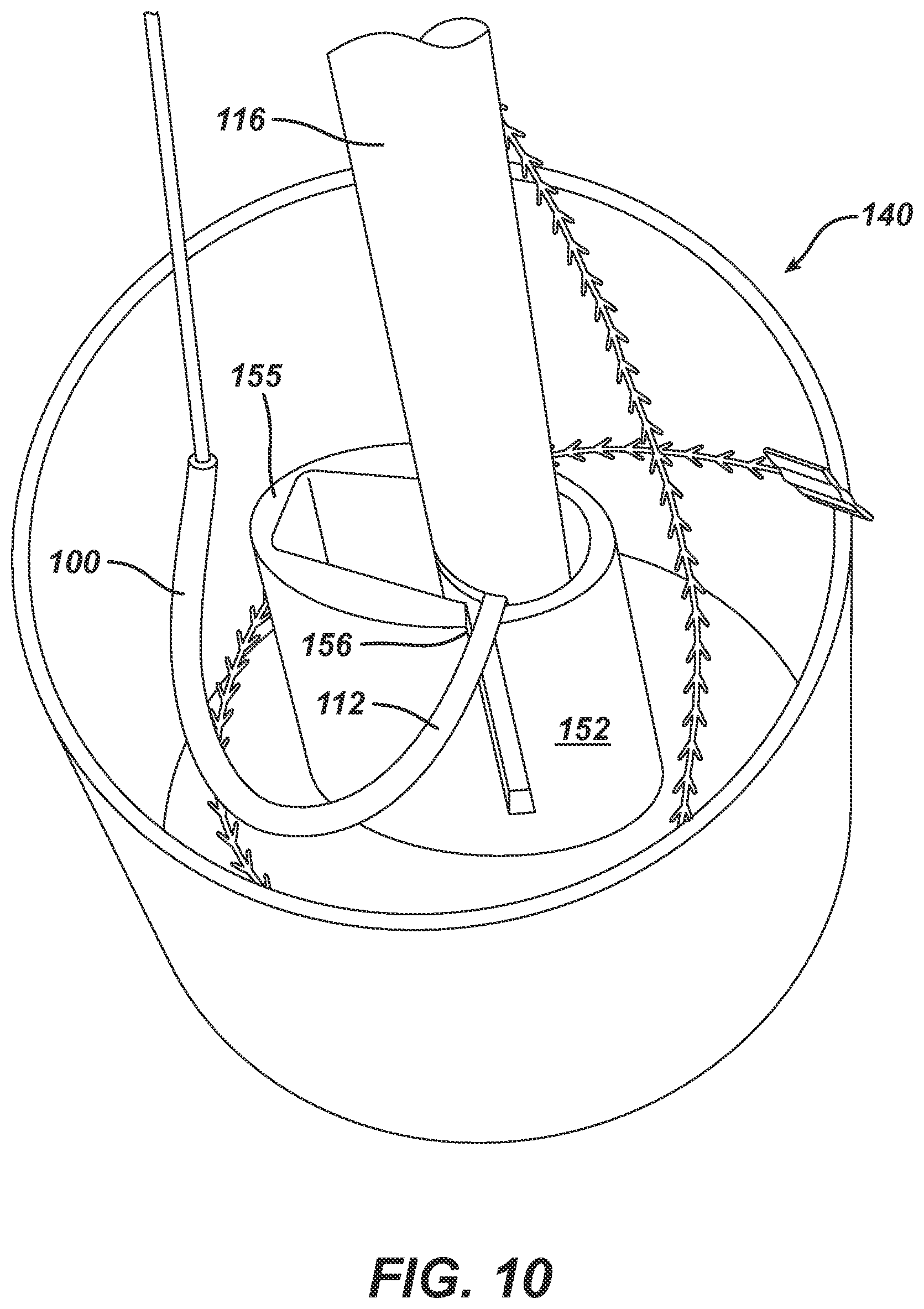 Patent US12303125 Figure 14 – Methods, systems and devices for storing suture needles and using robotics for delivering selected suture needles to surgical sites