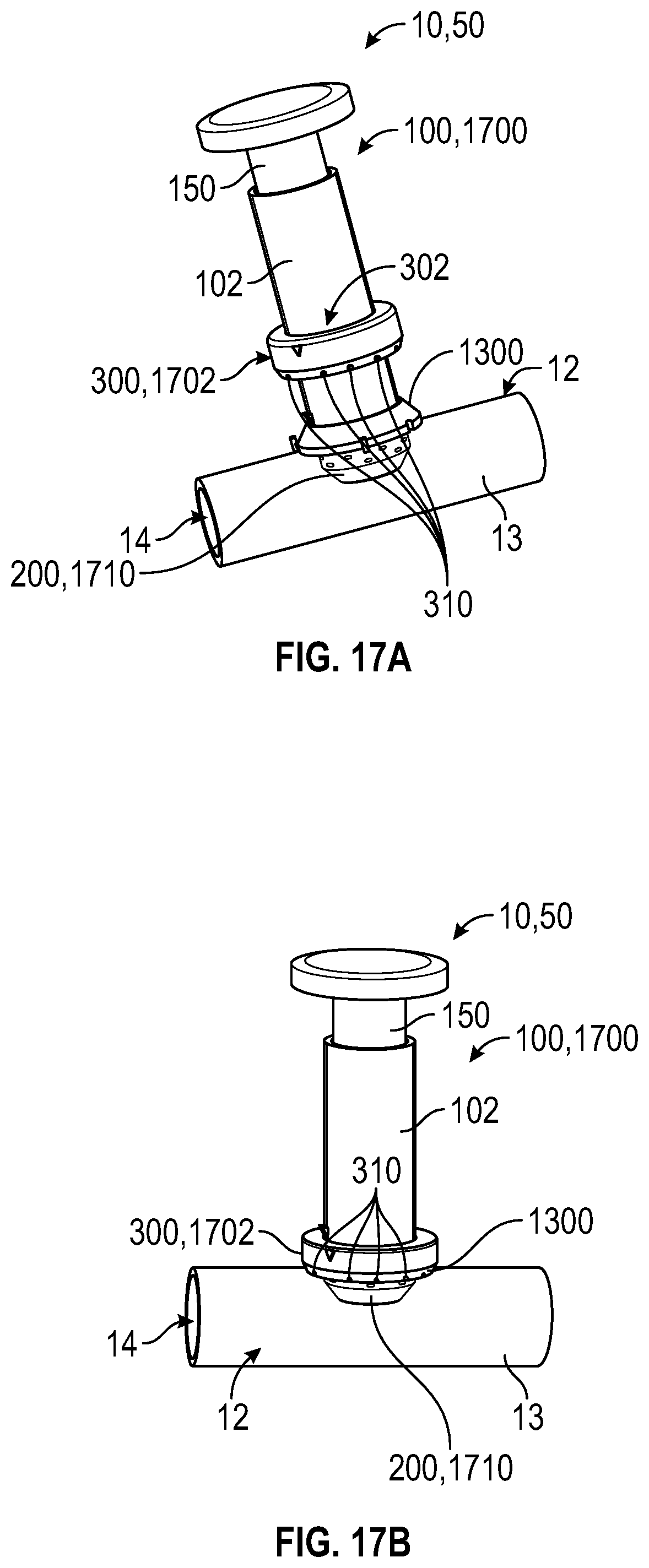 Patent US12303131 Figure 11 – Anastomotic coupler