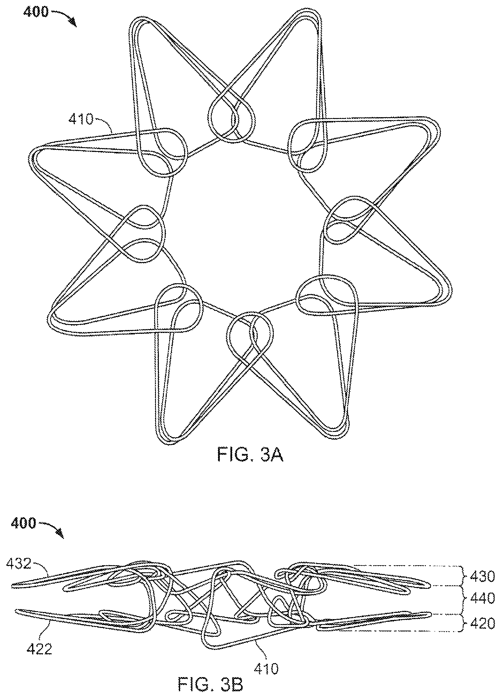 Patent US12303132 Figure 3 – Occluder and anastomosis devices