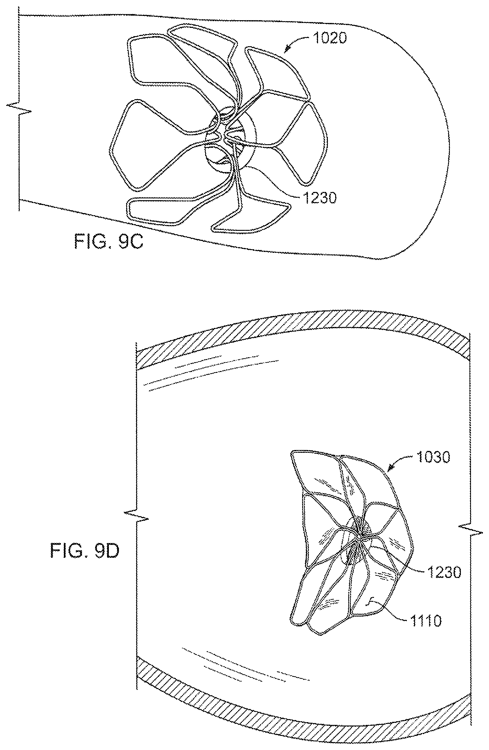 Patent US12303132 Figure 9 – Occluder and anastomosis devices