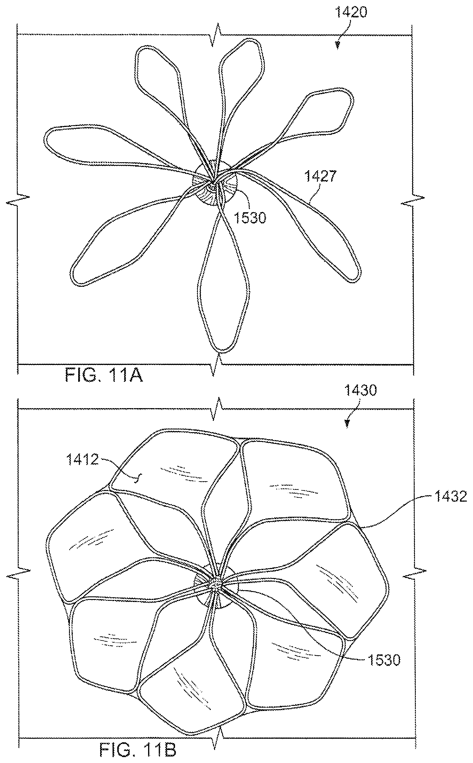 Patent US12303132 Figure 11 – Occluder and anastomosis devices