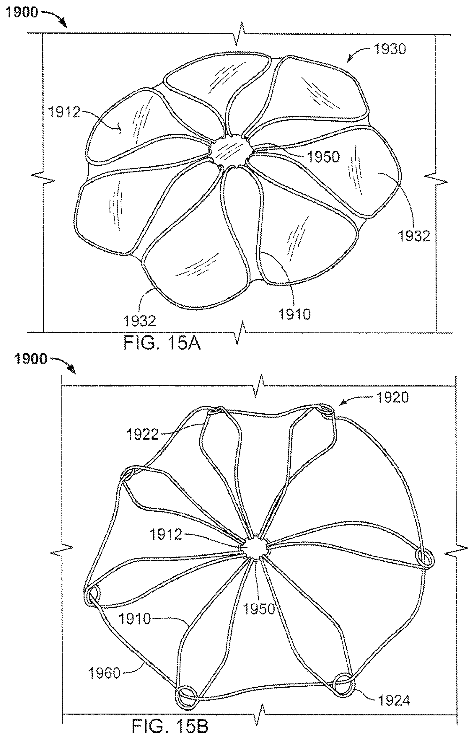 Patent US12303132 Figure 15 – Occluder and anastomosis devices