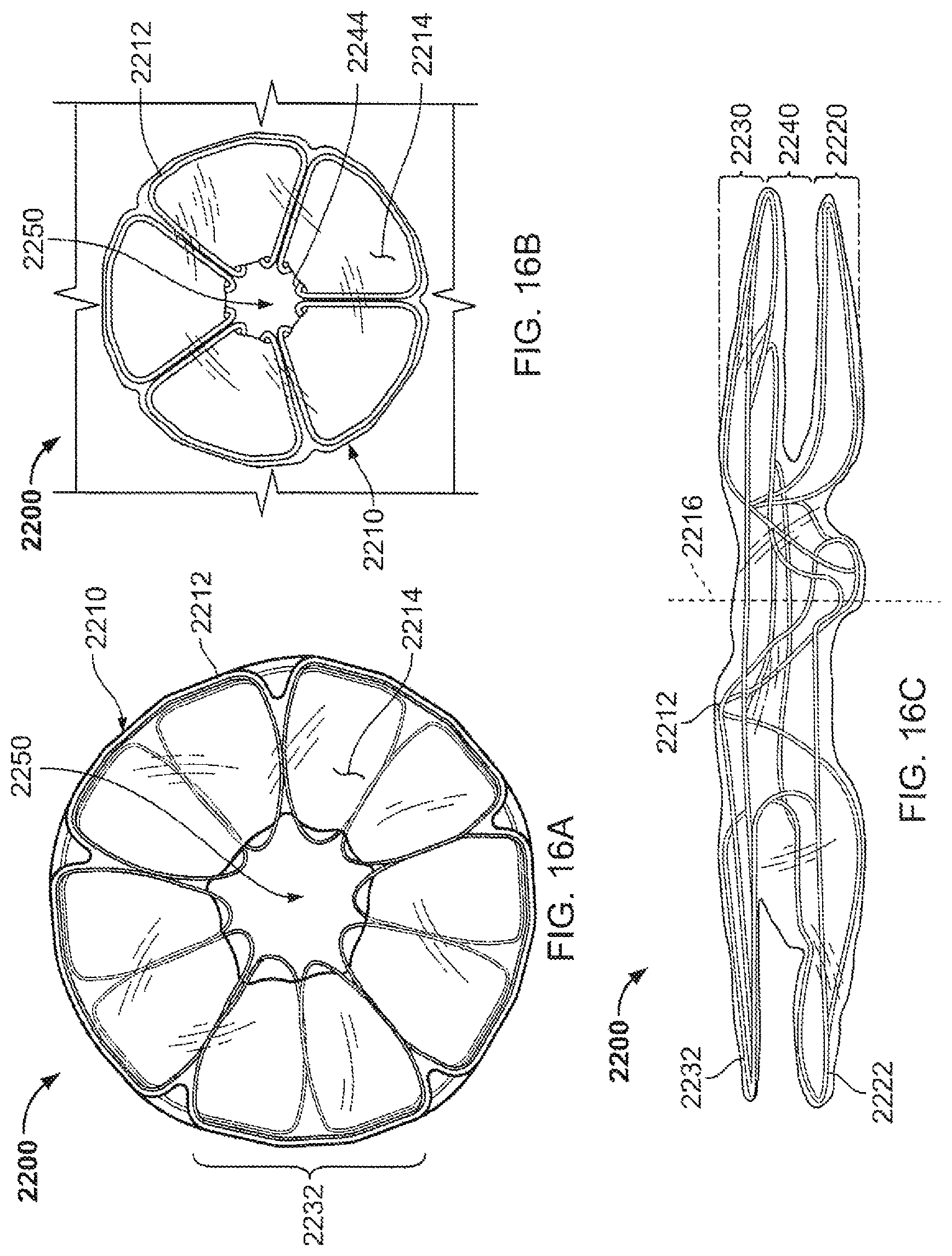 Patent US12303132 Figure 16 – Occluder and anastomosis devices