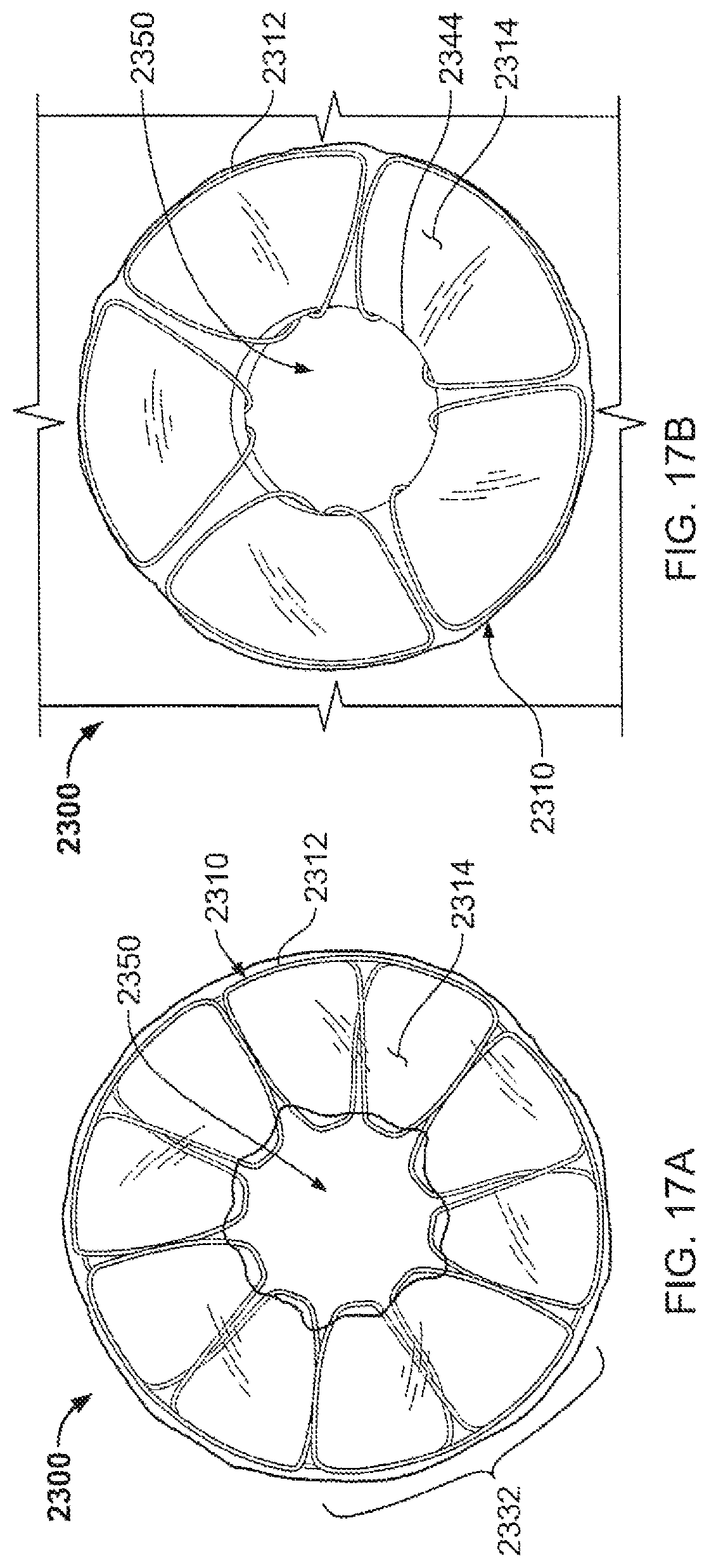 Patent US12303132 Figure 17 – Occluder and anastomosis devices