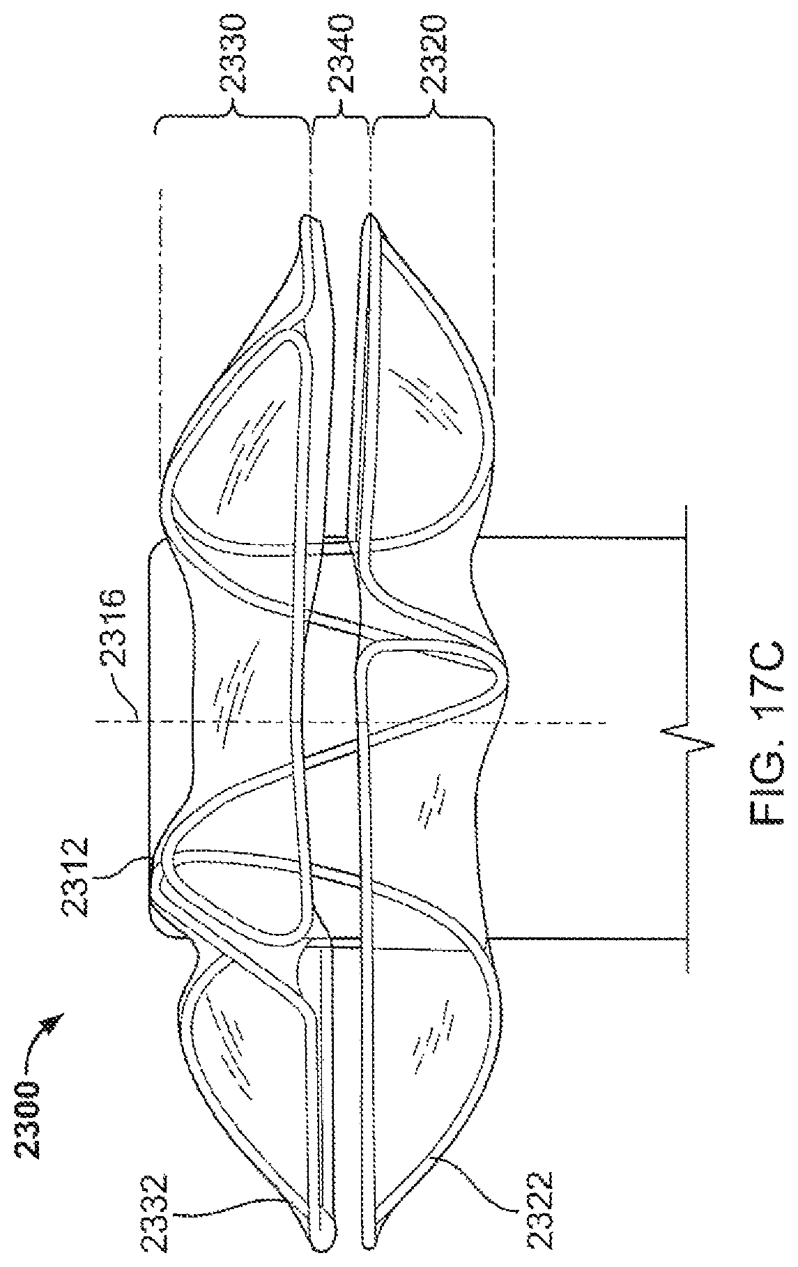 Patent US12303132 Figure 18 – Occluder and anastomosis devices