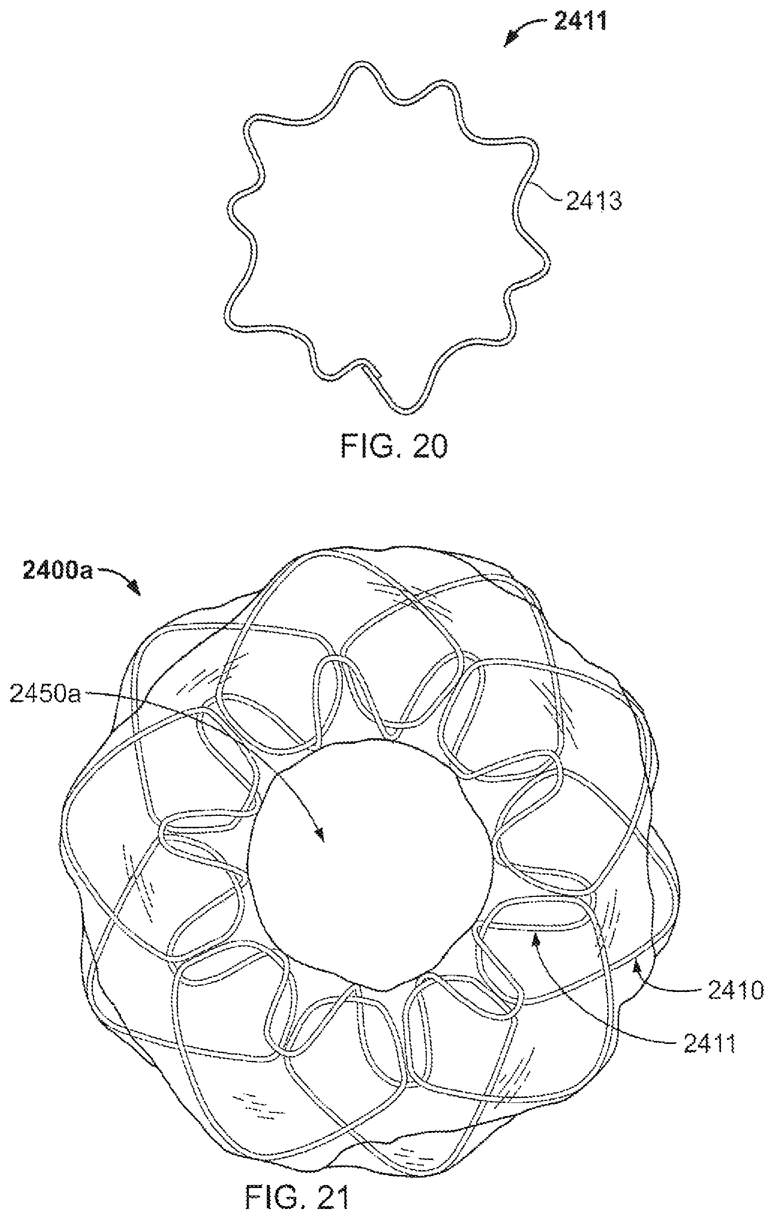 Patent US12303132 Figure 20 – Occluder and anastomosis devices