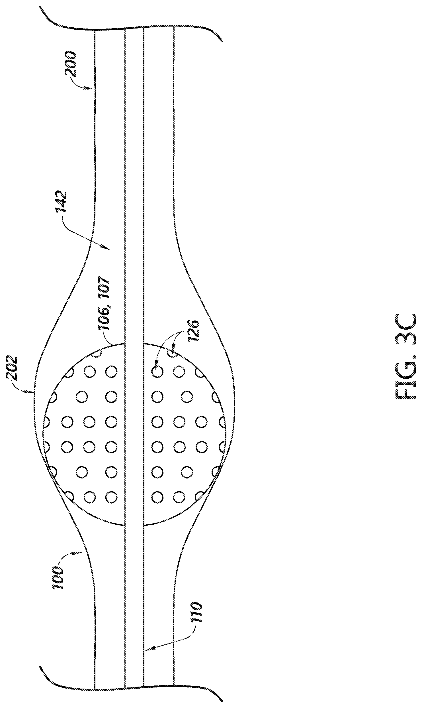Patent US12303134 Figure 7 – Systems for aneurysm treatment