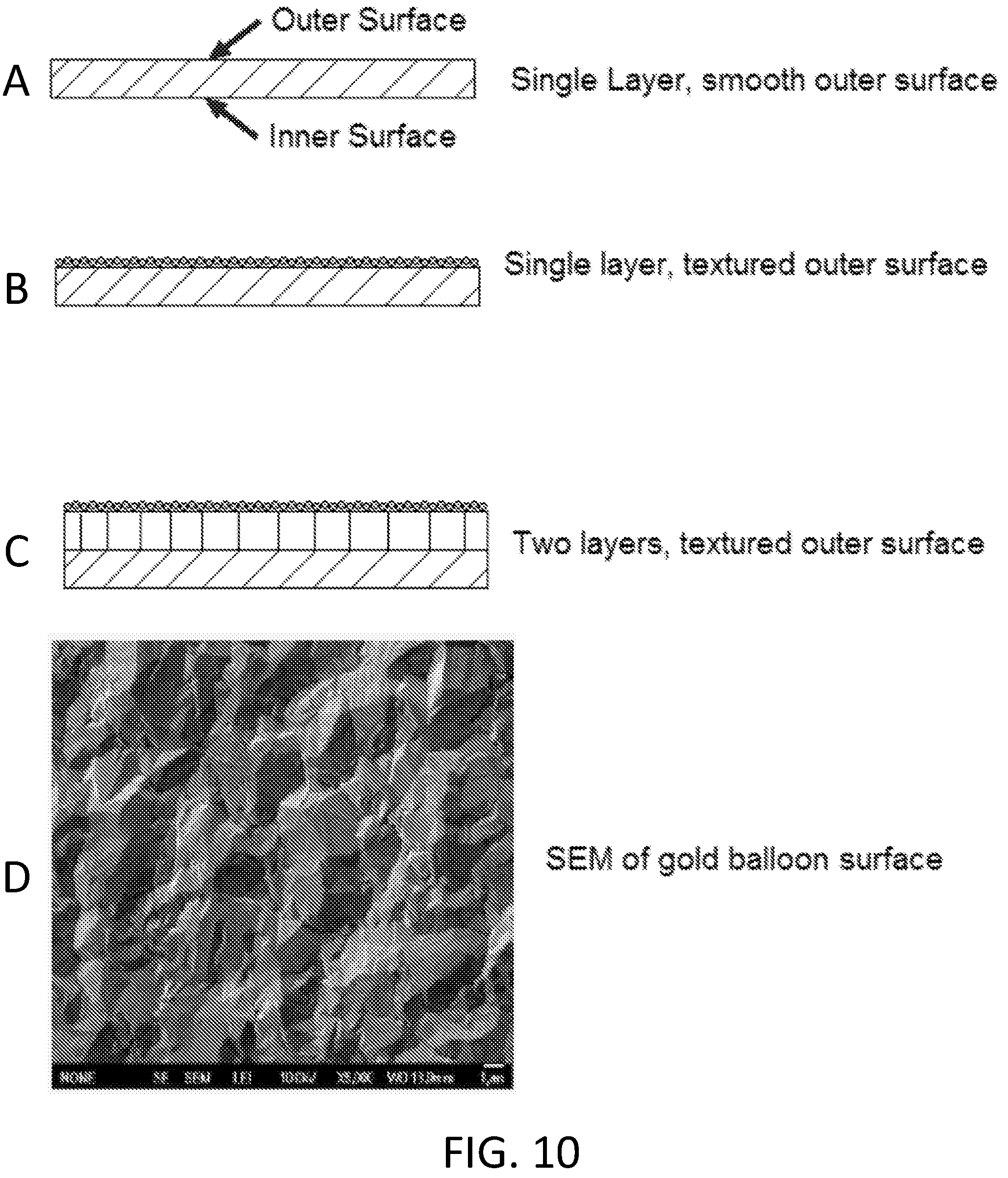 Patent US12303135 Figure 18 – Medical devices comprising detachable balloons and methods of manufacturing and use