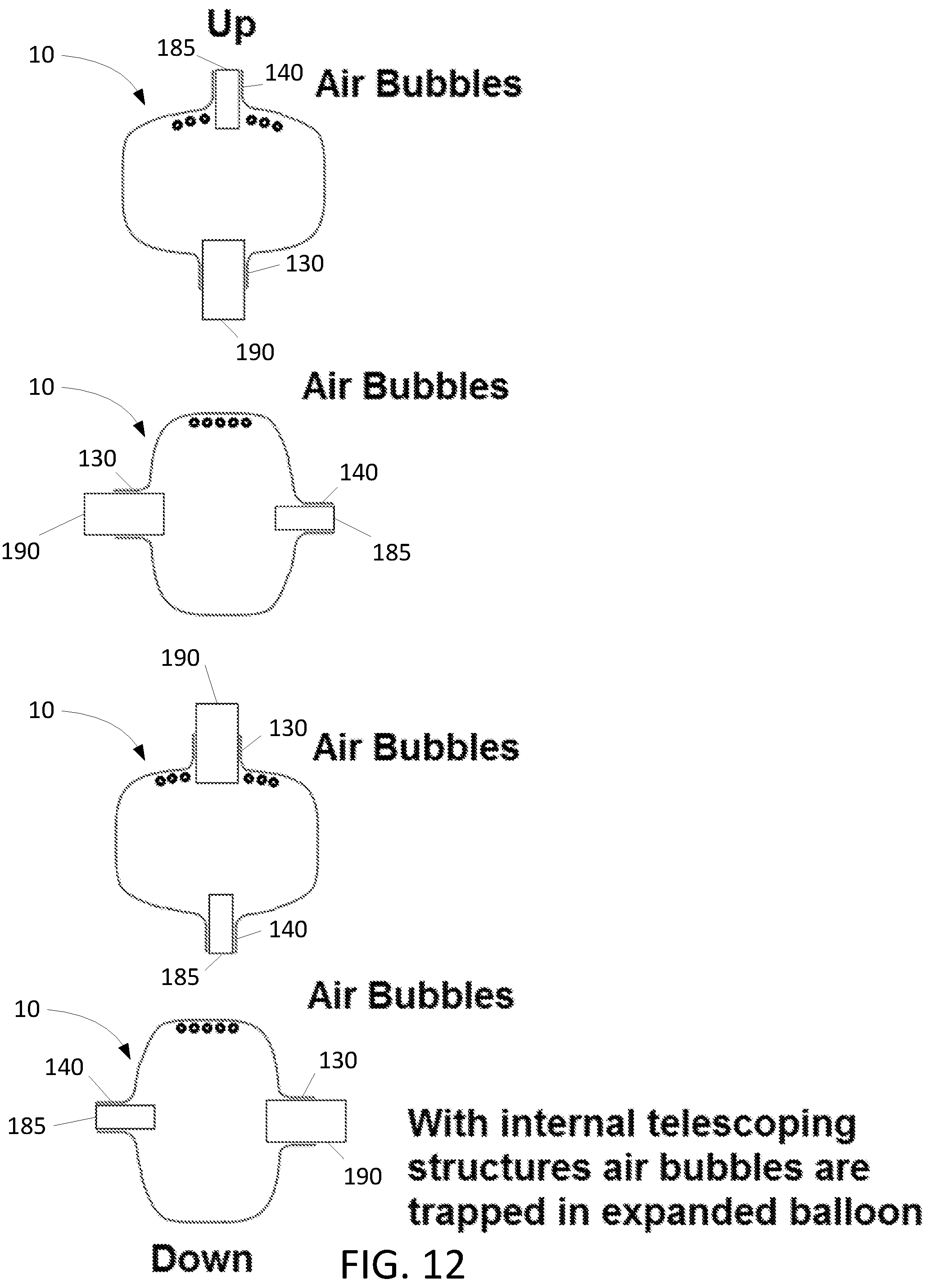 Patent US12303135 Figure 20 – Medical devices comprising detachable balloons and methods of manufacturing and use