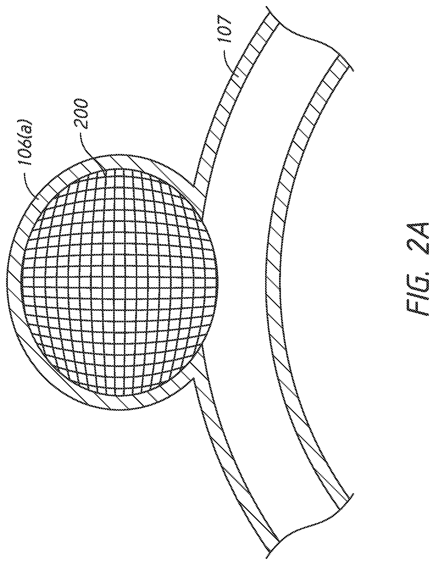 Patent US12303136 Figure 2 – System and methods for embolized occlusion of neurovascular aneurysms